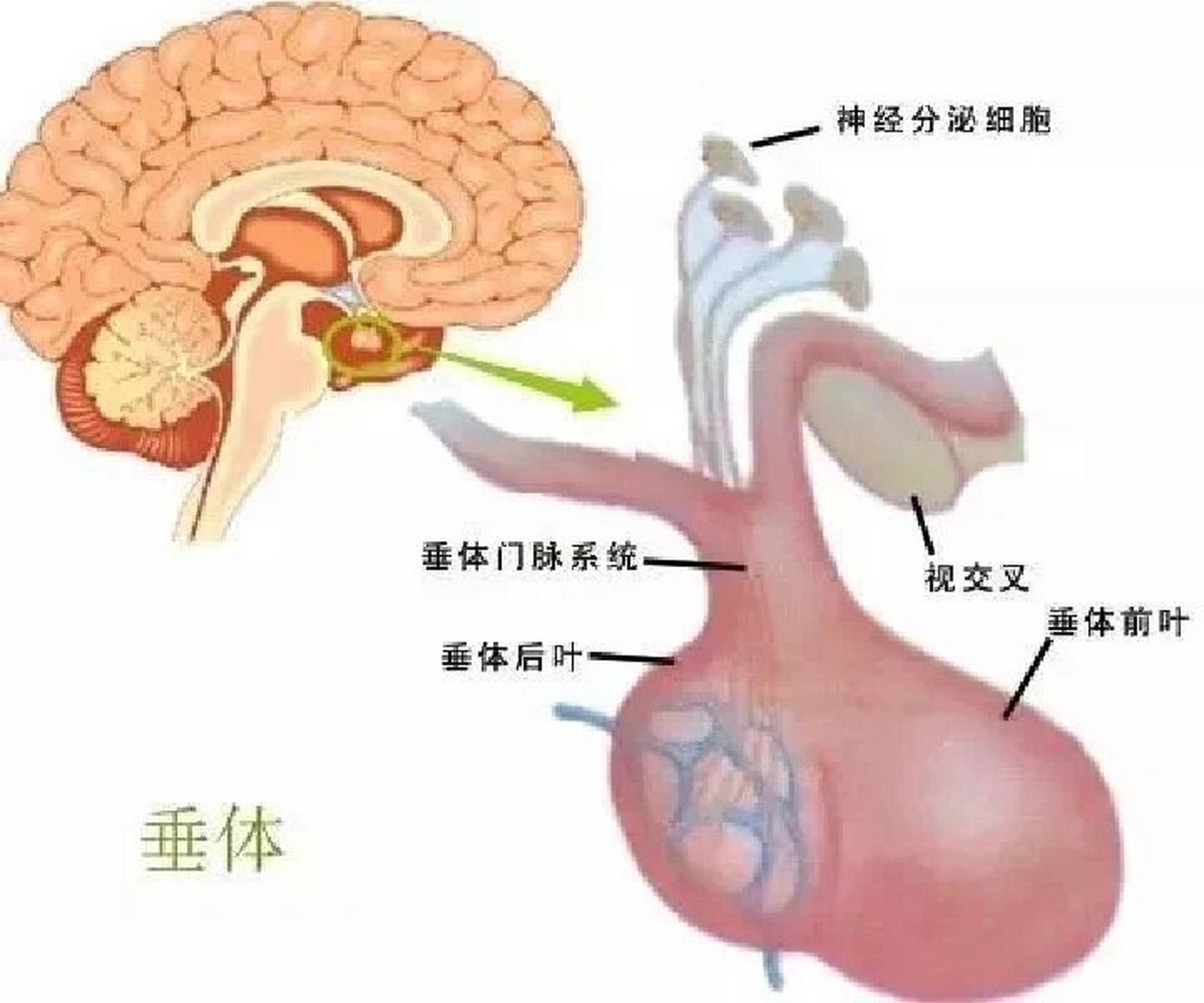 脑垂体切除图片