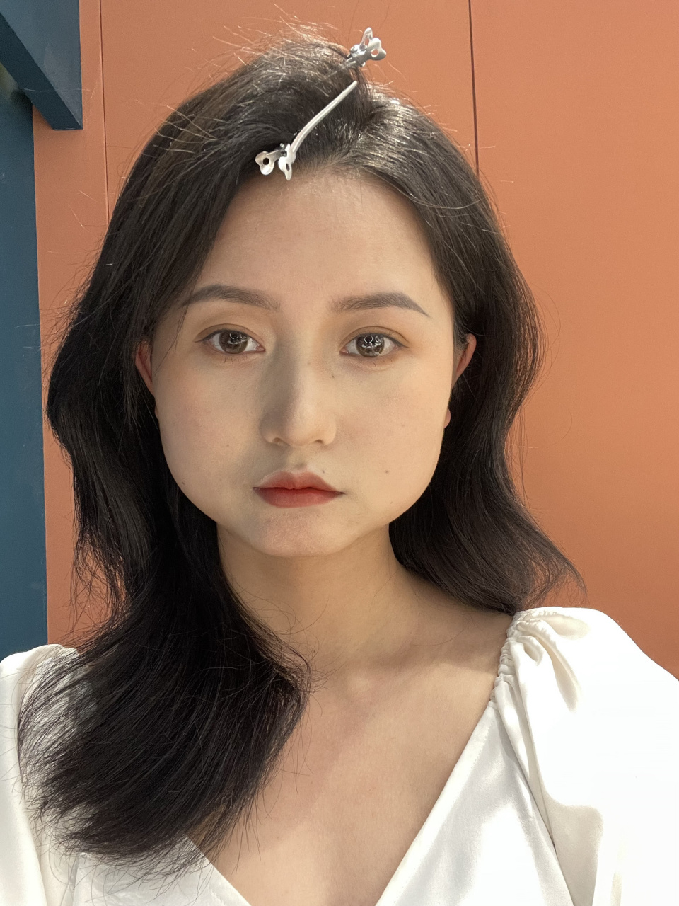 正畸 | 方脸正畸半年的改变 正畸半年选手来反馈一下,我就是深覆合方