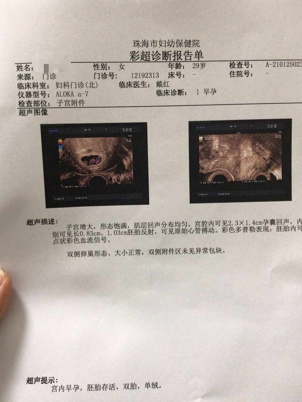 有没有姐妹知道单绒双胎的,求解答 昨天去照的b超,医生没照多久就说