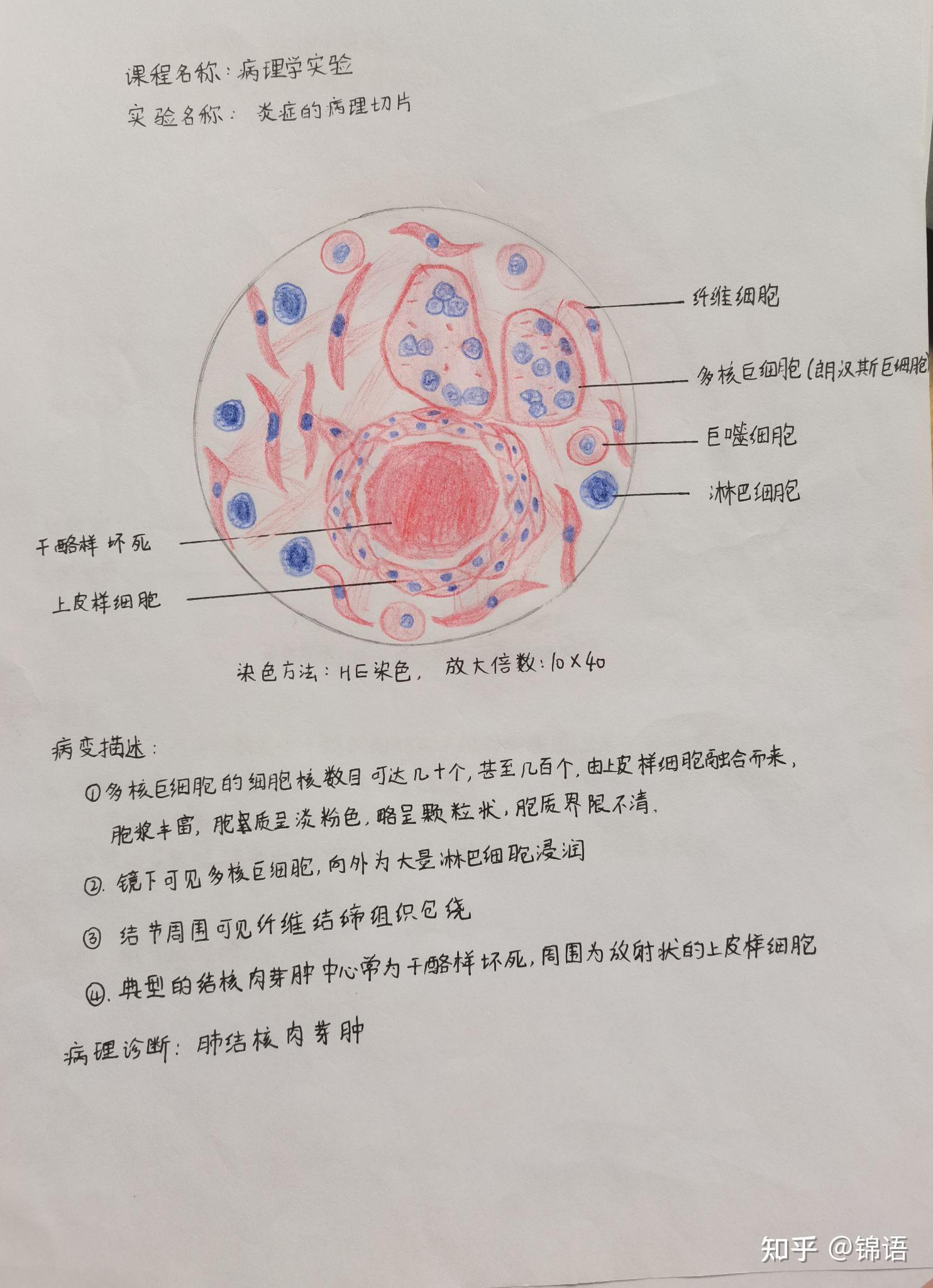 结核杆菌红蓝铅笔图图片