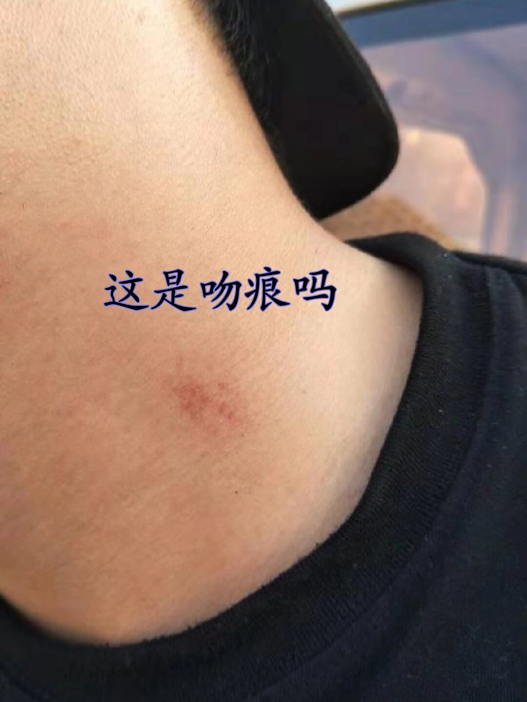 这是吻痕吗?我没吻他,可他却不知道