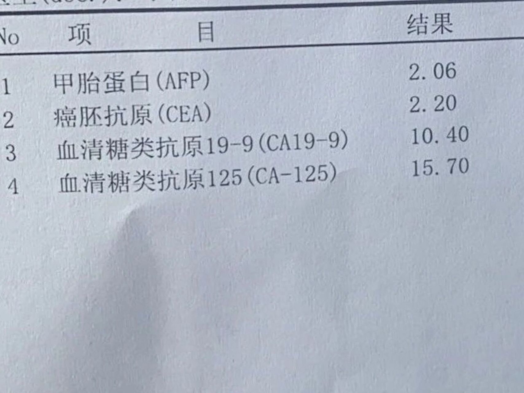 肝癌化验单结果图片图片