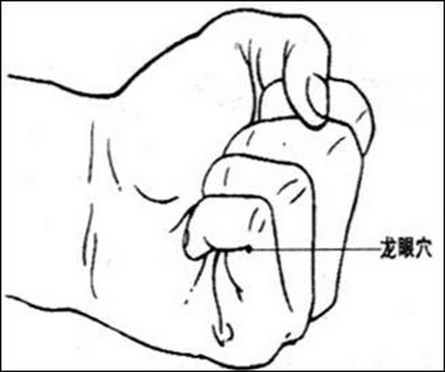 经外奇穴龙眼穴——治疗带状疱疹 本病特点是皮肤呈