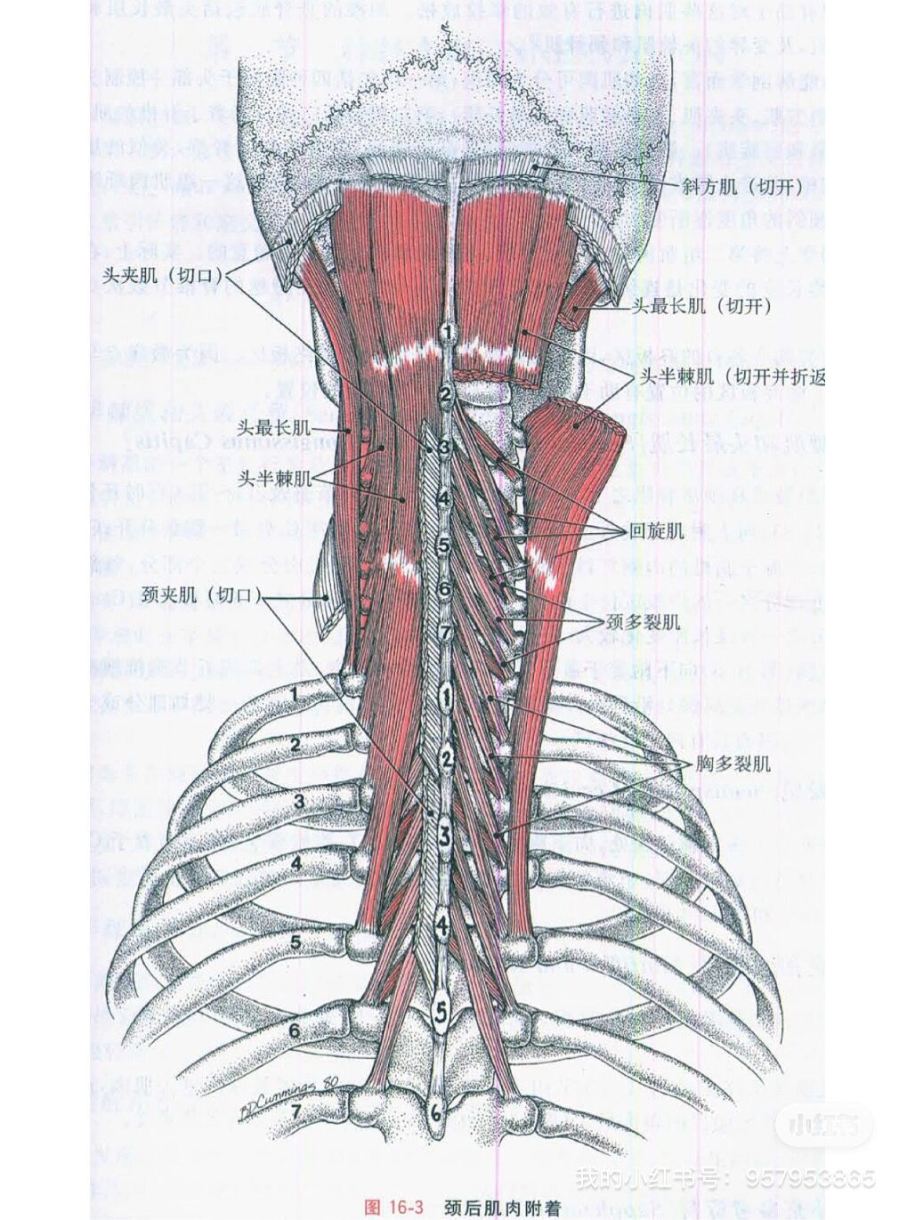 25.颈后肌群的常见肌筋膜疼痛