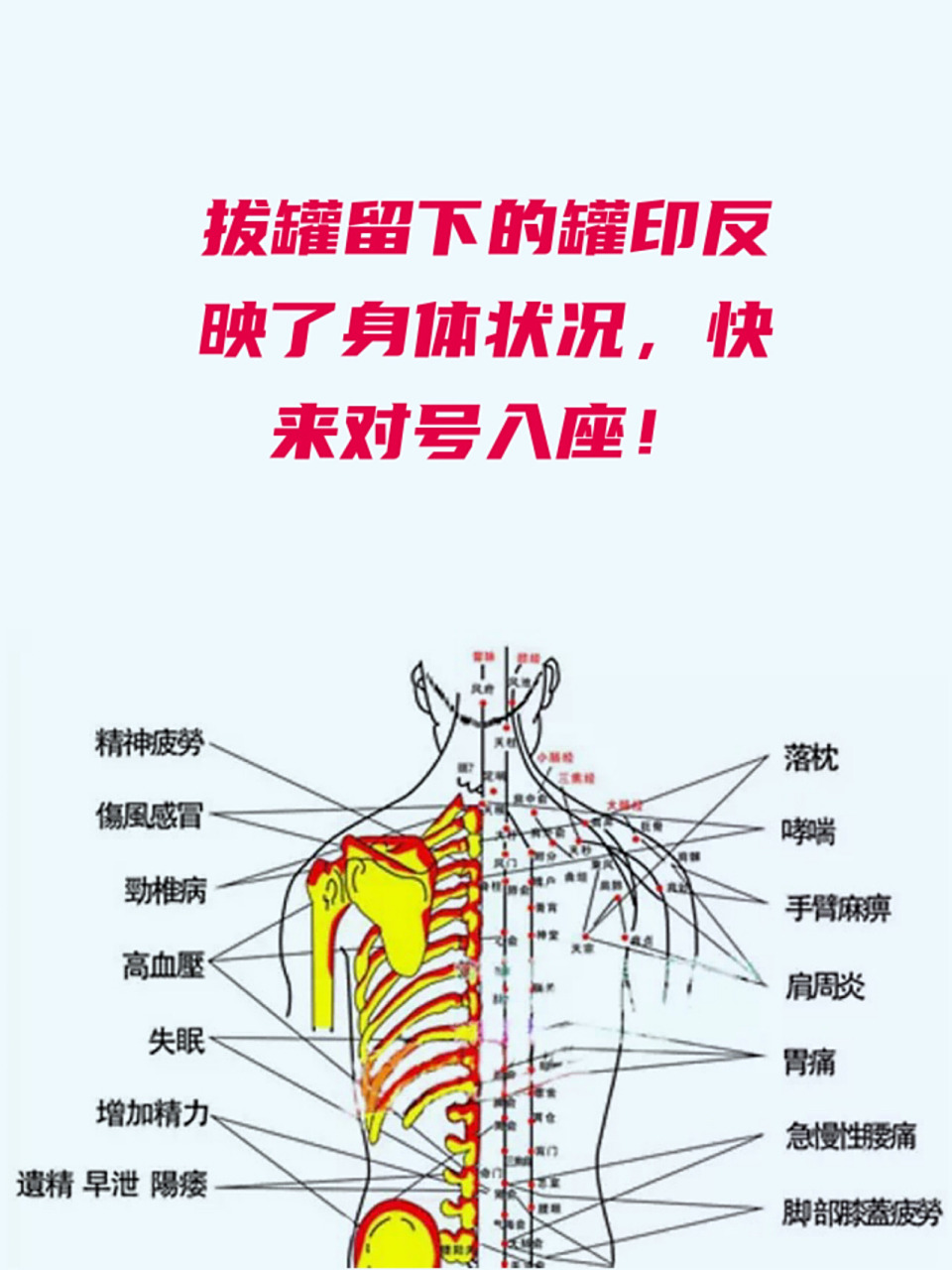 拔火罐是我们最健康,最原始的调理身体,预防疾病的方式,很多人在感觉