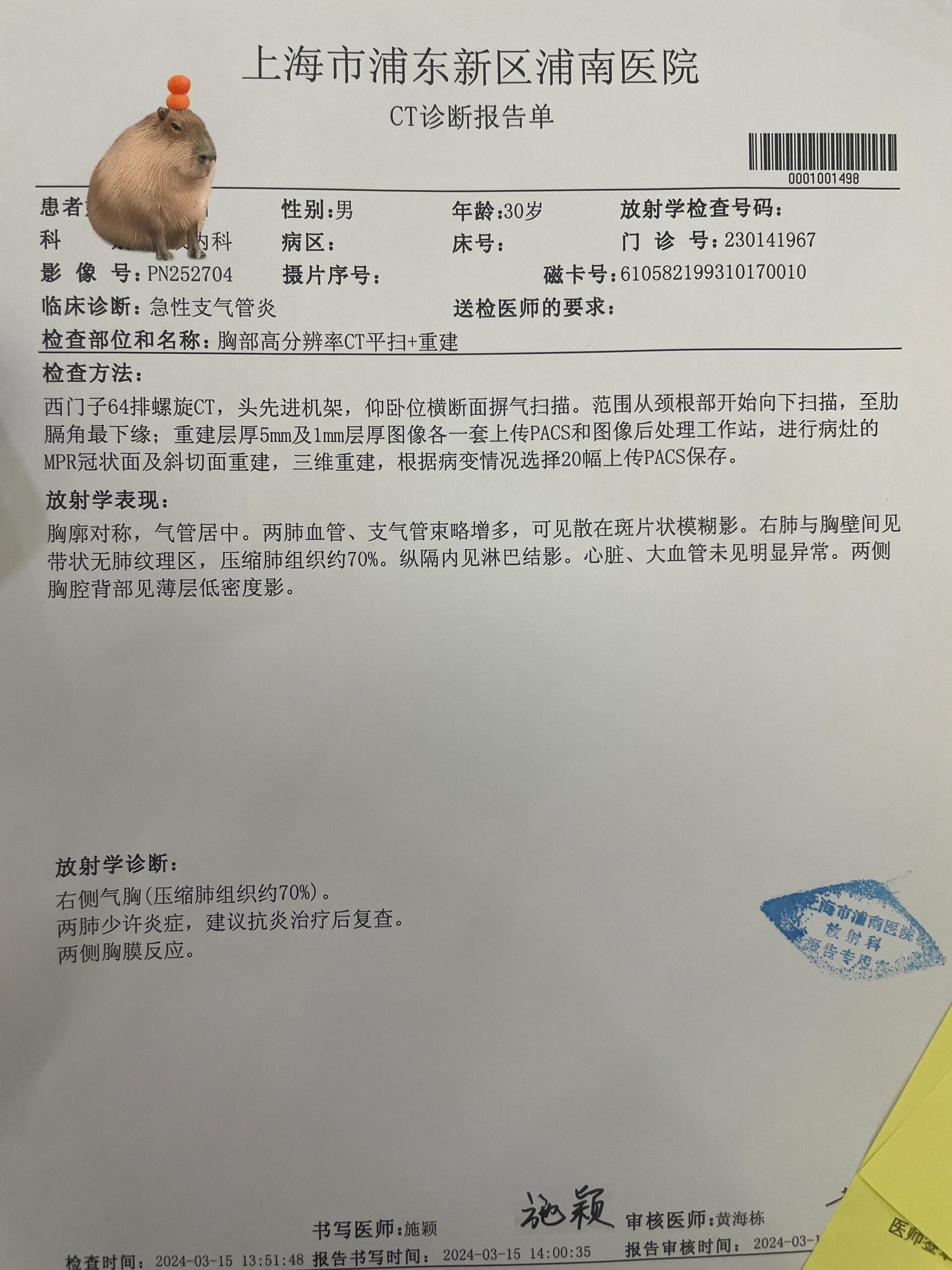 30岁了,第一次突发气胸 发病当天右肺03气体 70% ,医生要求插管引流