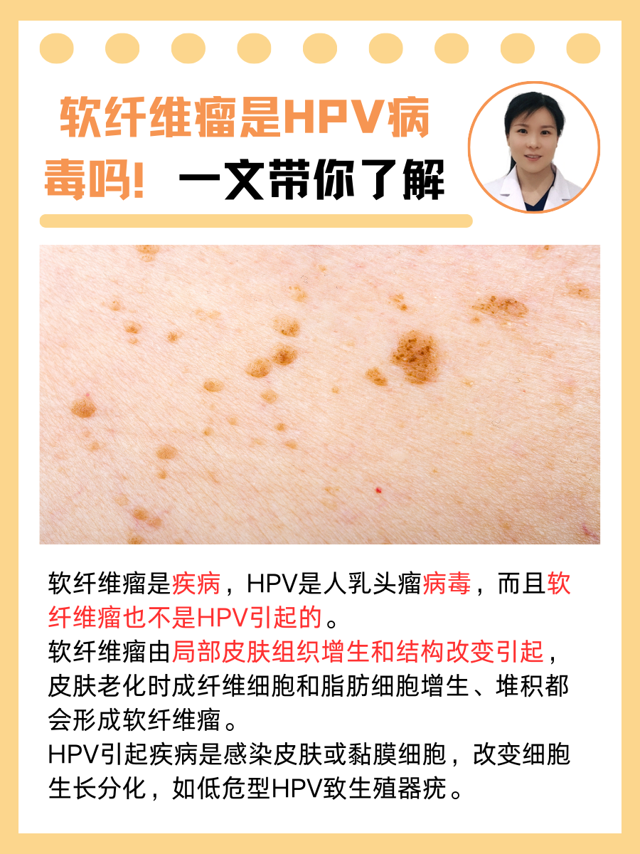 一文带你了解 软纤维瘤是一种常见的皮肤良性肿瘤,又称为皮赘.