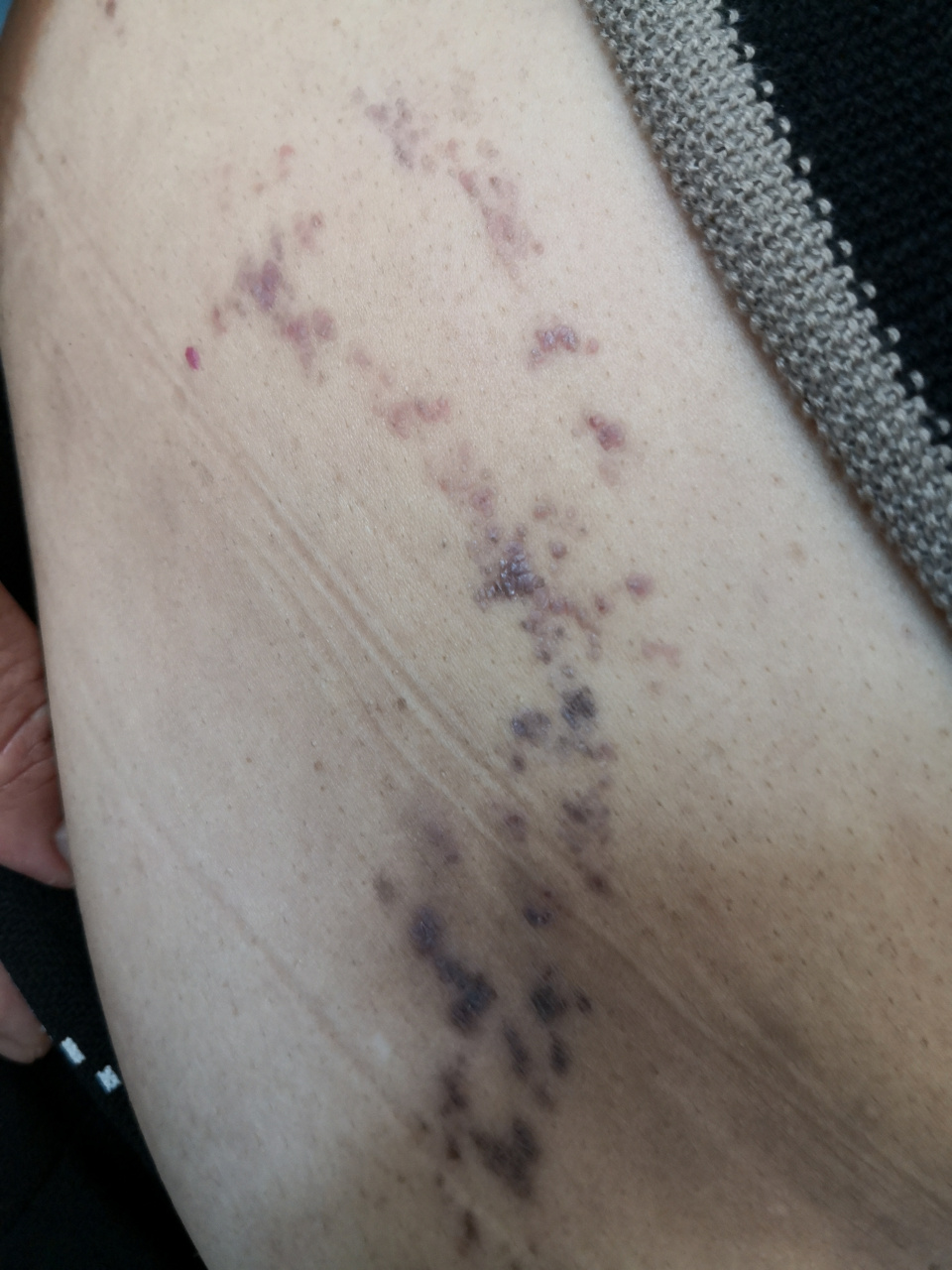 解决皮肤问题专注皮肤美容##皮肤