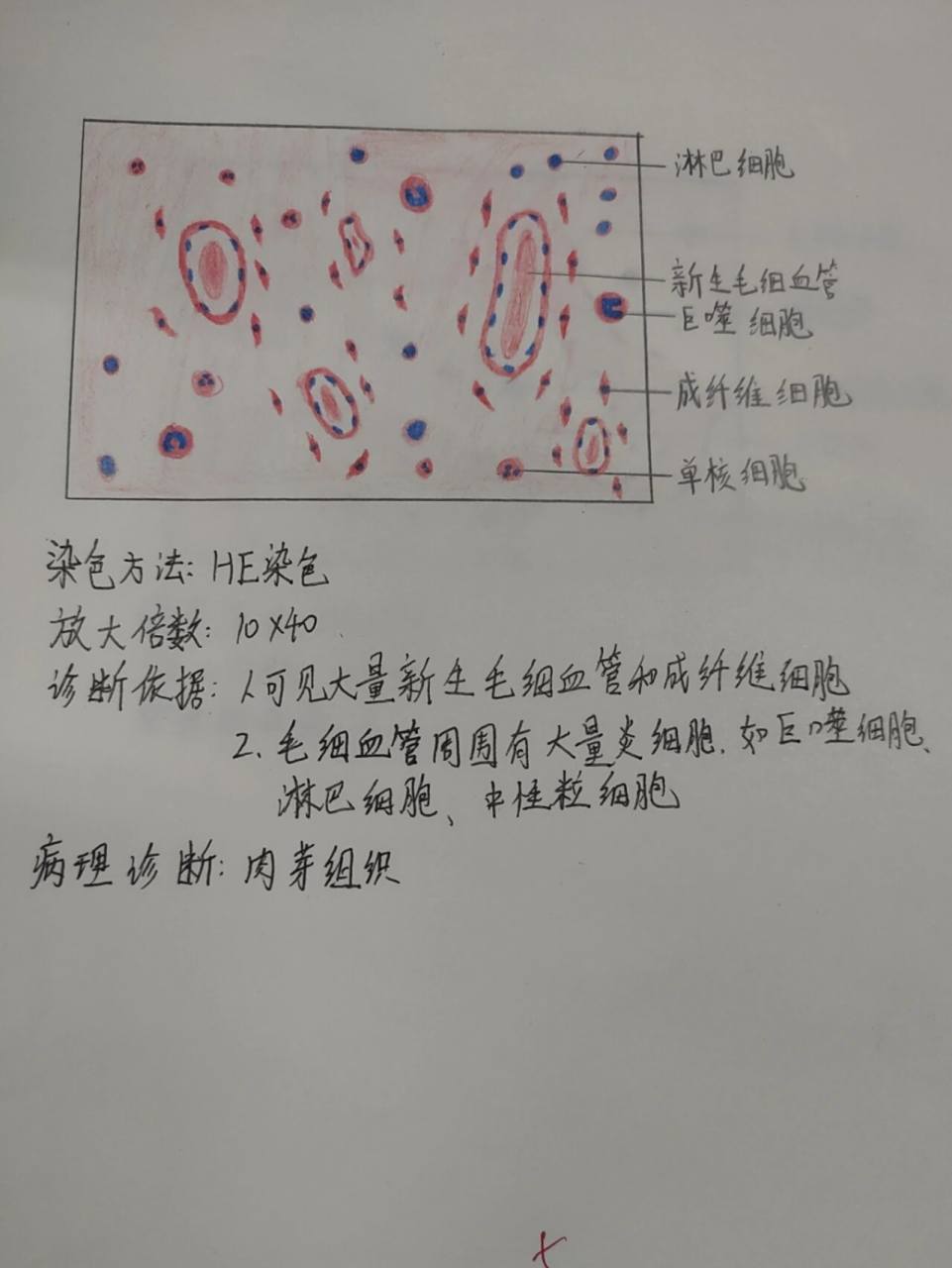 病理绘图-肉芽组织