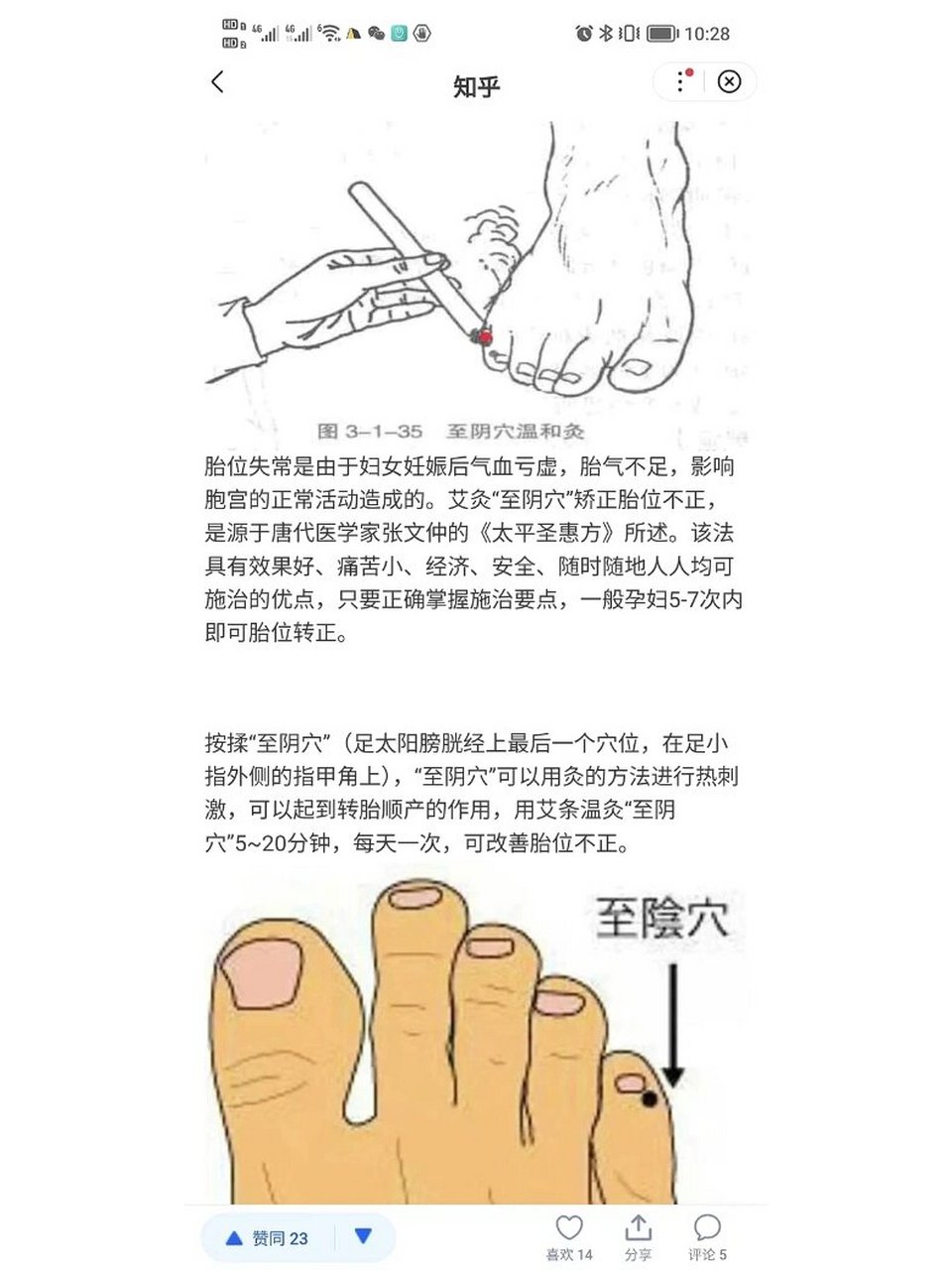 艾灸反馈|艾灸一周纠正胎位成功 今天收到艾灸姐妹反