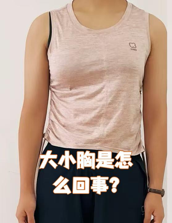 大小胸是指两侧乳房明显不对称