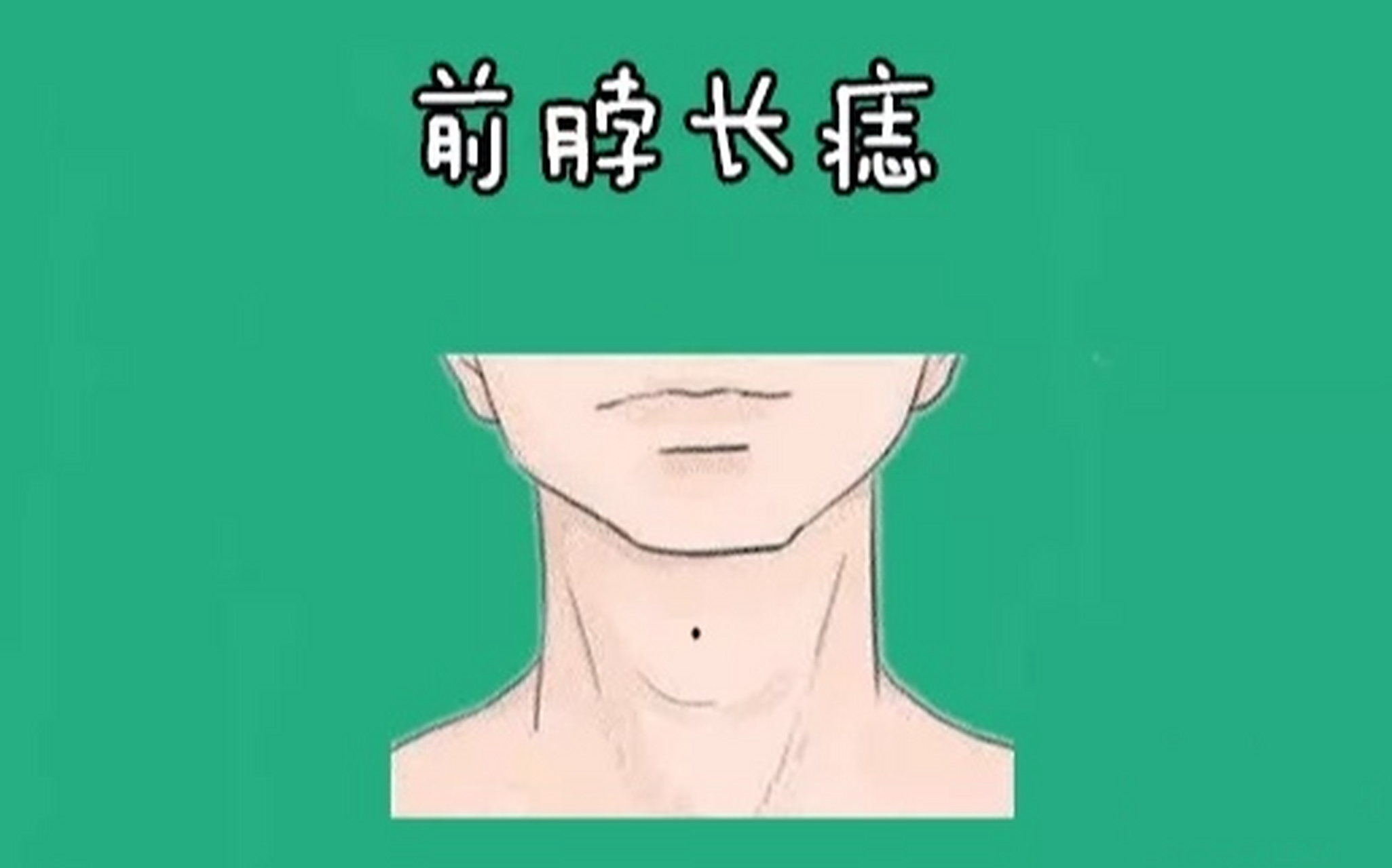 我们都知道长在脖子处的痣属于靠山痣,但若是痣长在前脖的位置处,长有