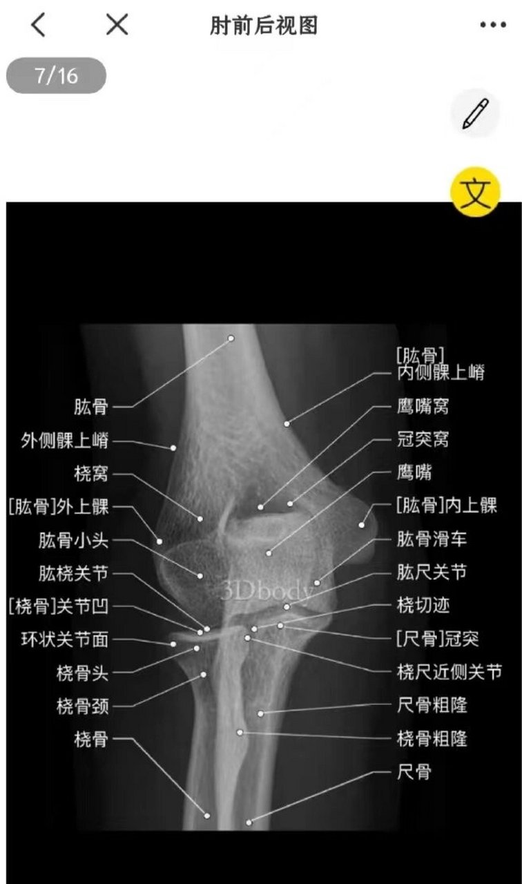 肘关节侧位解剖图图片