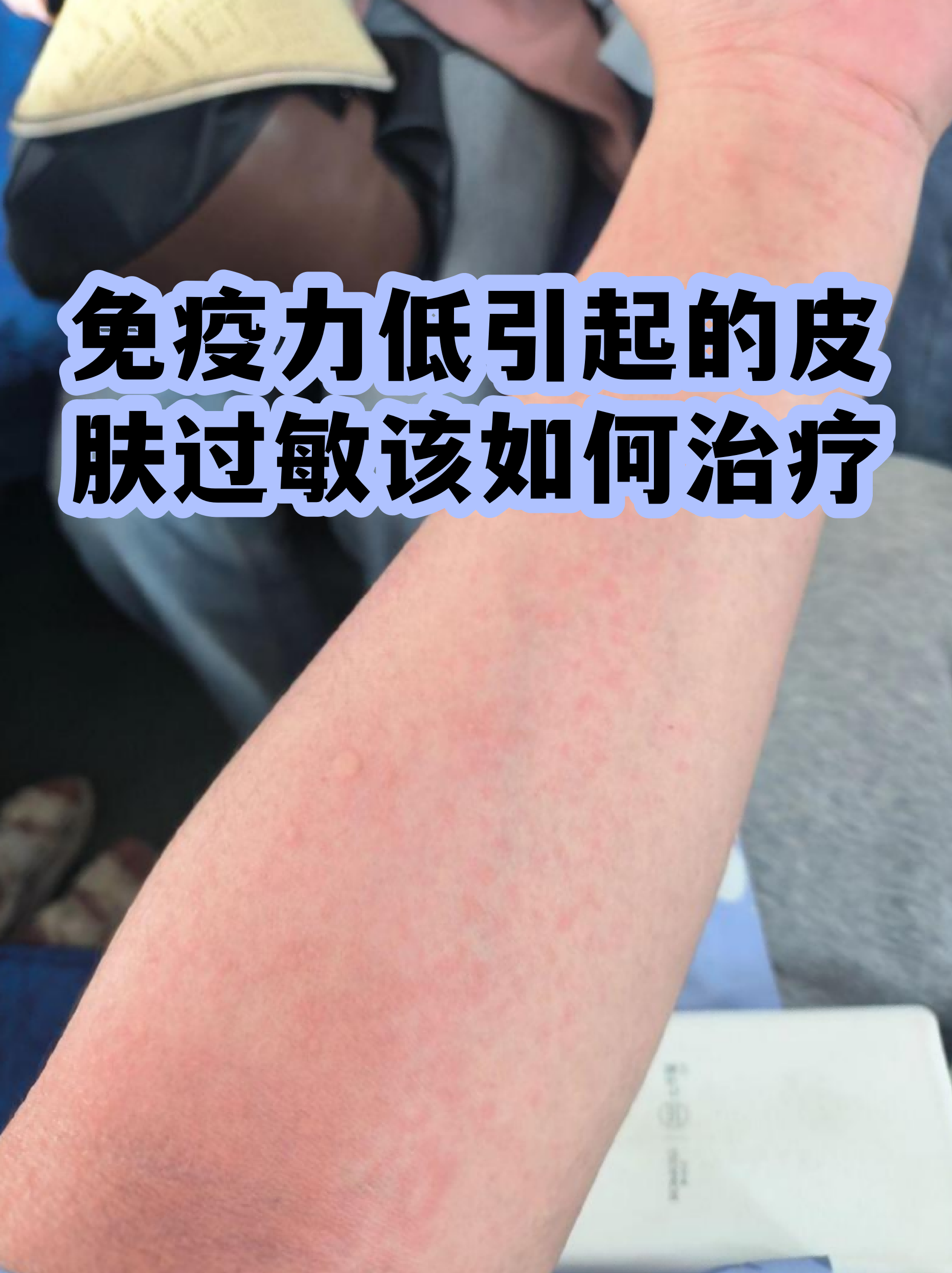 关于西苑医院代诊挂号服务复杂病情综合分析,治疗方向更明确的信息 关于西苑医院代诊挂号服务复杂病情综合分析,治疗方向更明确的信息