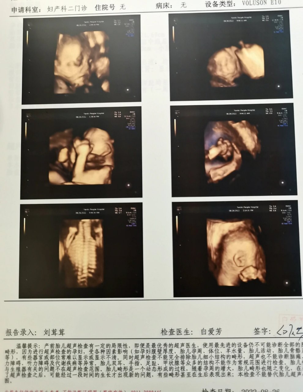 四维数据可以看男女?那这是男宝还是女宝