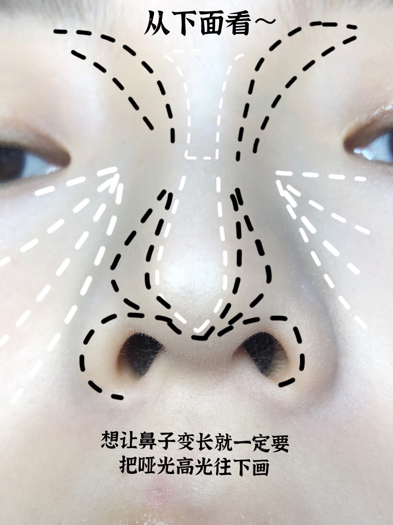 干货|塌鼻梁短鼻子如何变成纤细长鼻梁?