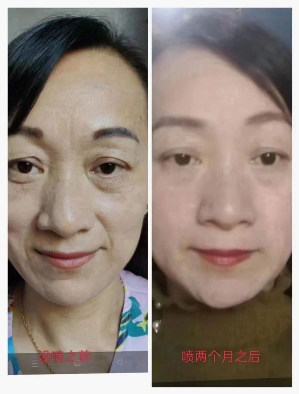 十钟分69见效,91 可效有69 金木集团74爆品 【舒美惠赋活