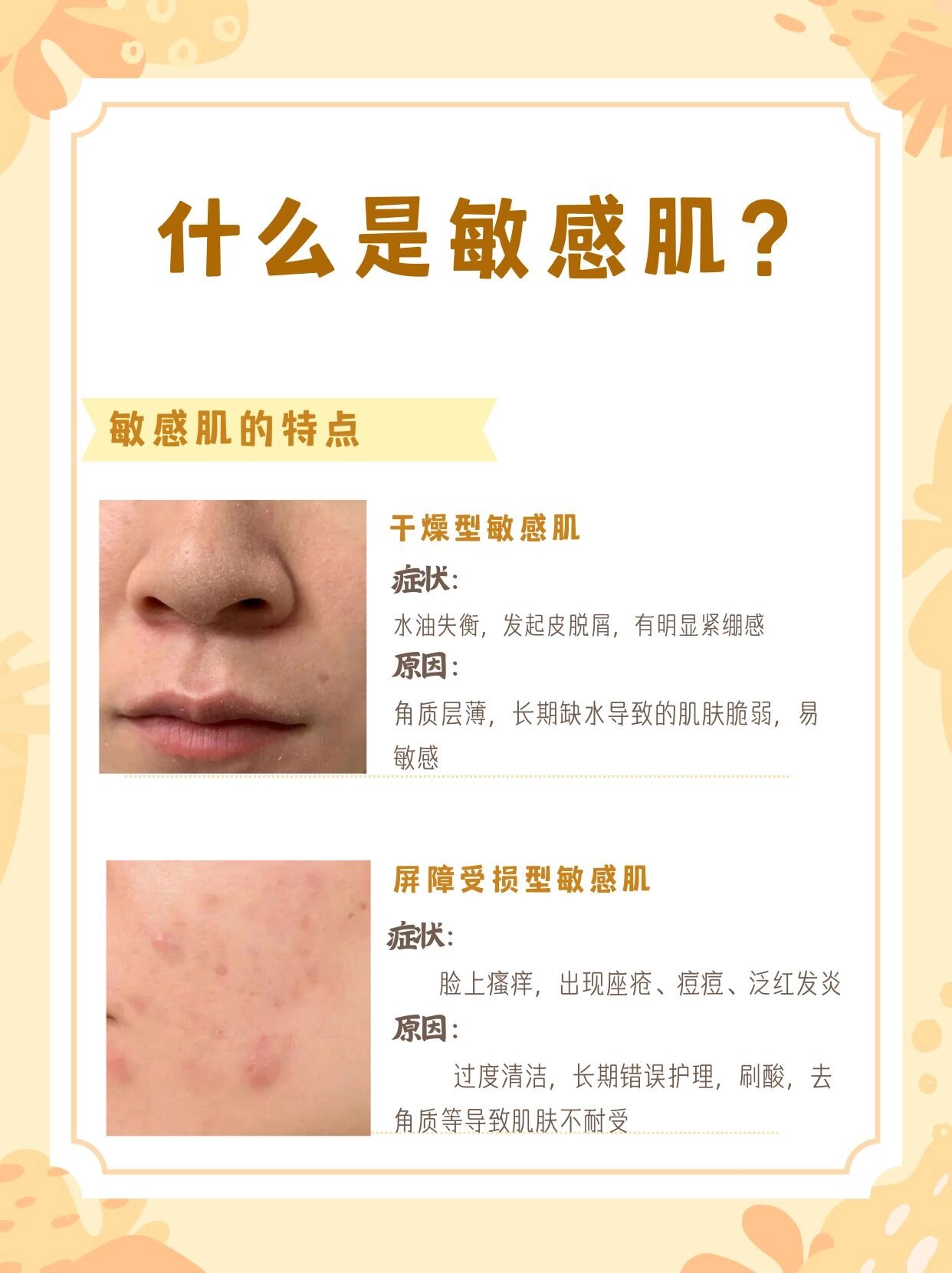 一分钟教你判断你是哪种敏感肌04