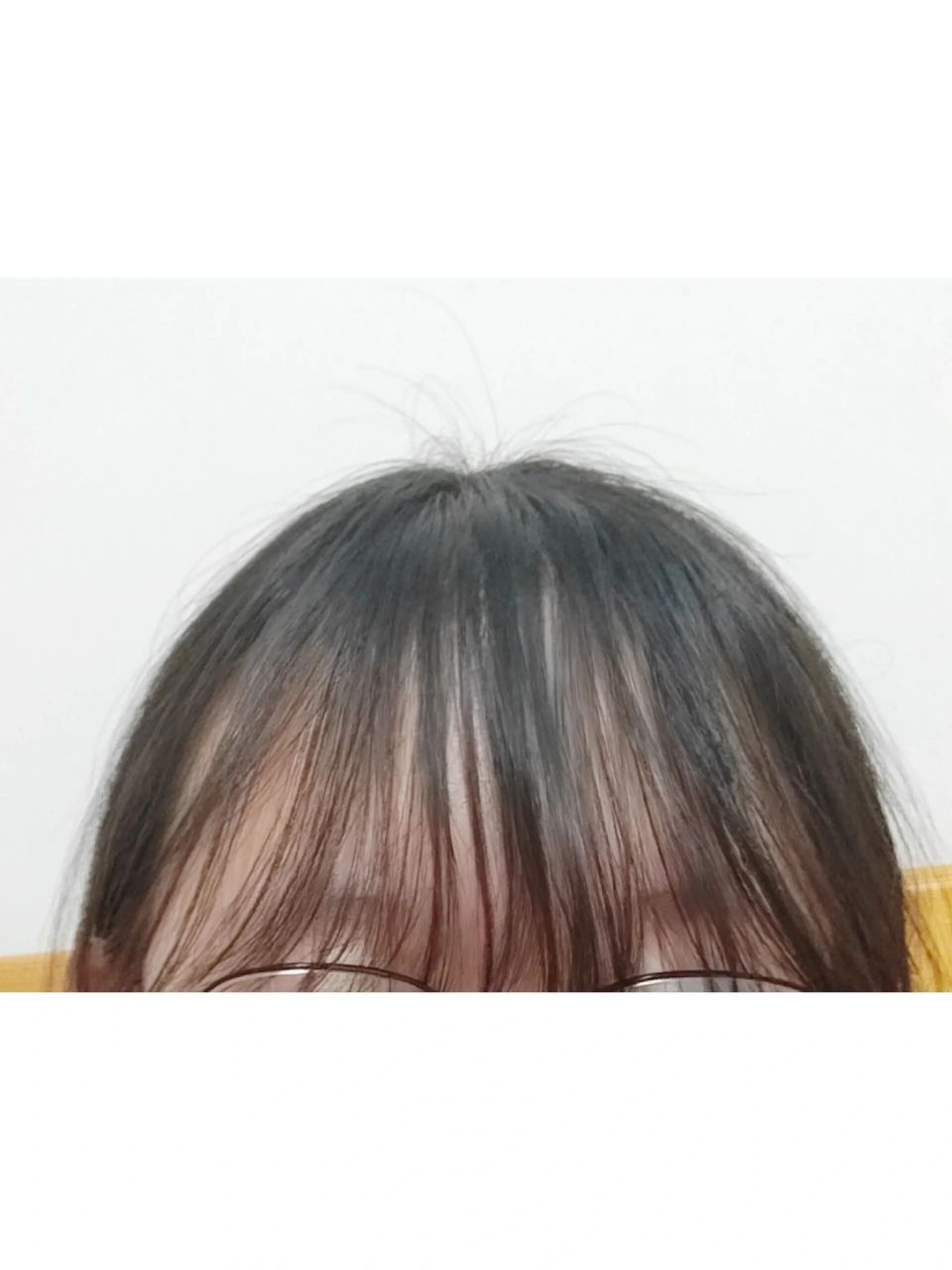 高额头刘海 因为发际线高不得不留刘海 但是早上刚洗刘海晚上就变成