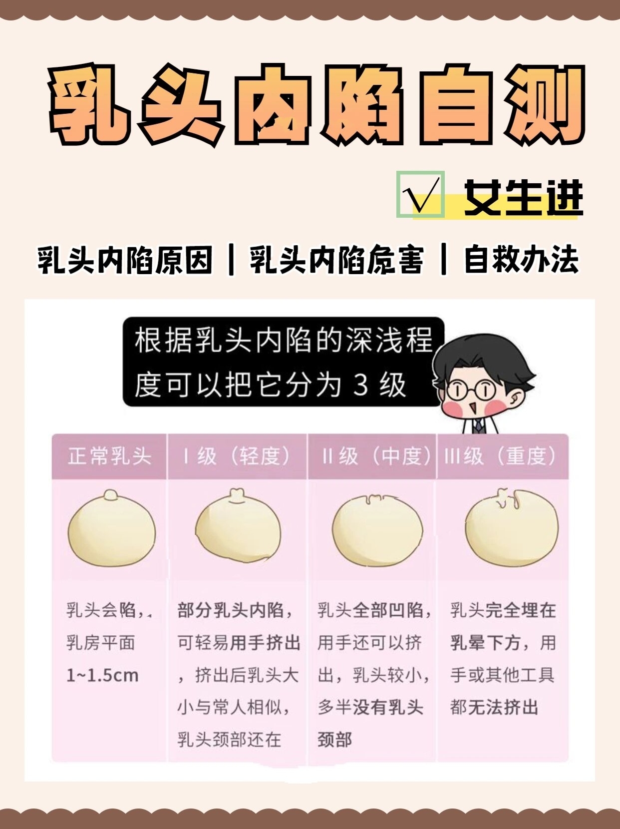 大乳头女性 正常 外观图片