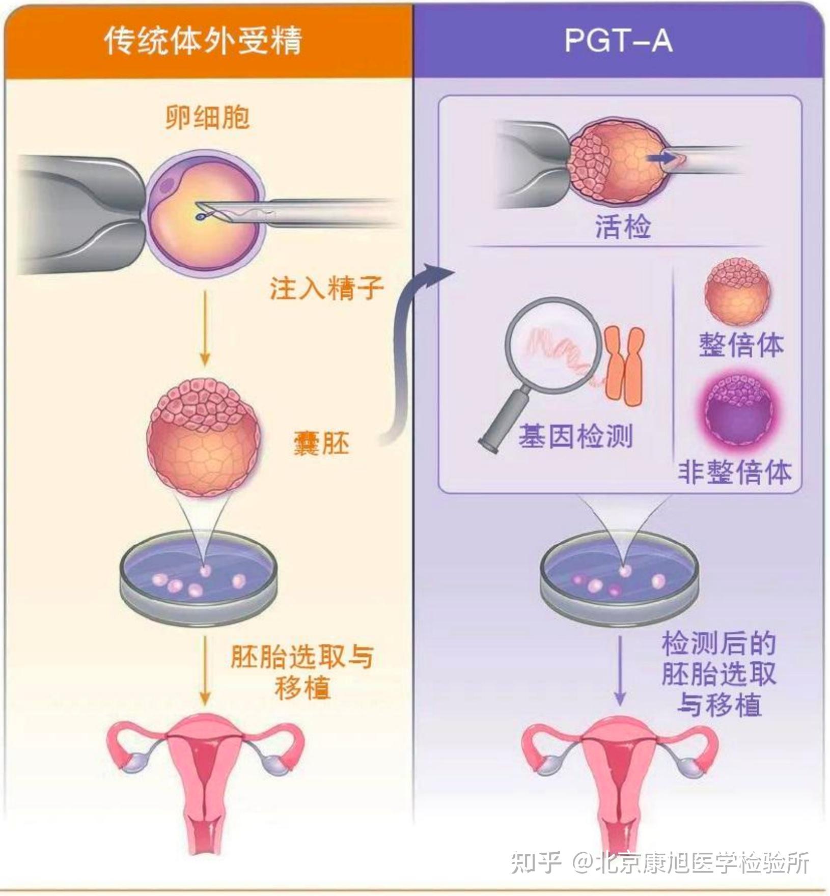 三代试管过程图片