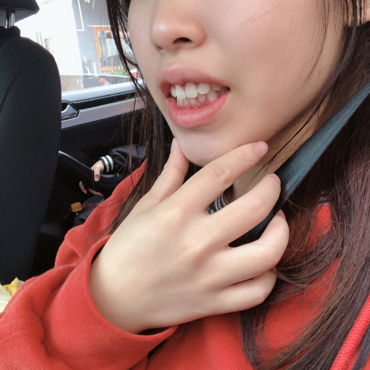 厚唇改薄术后12天 1.