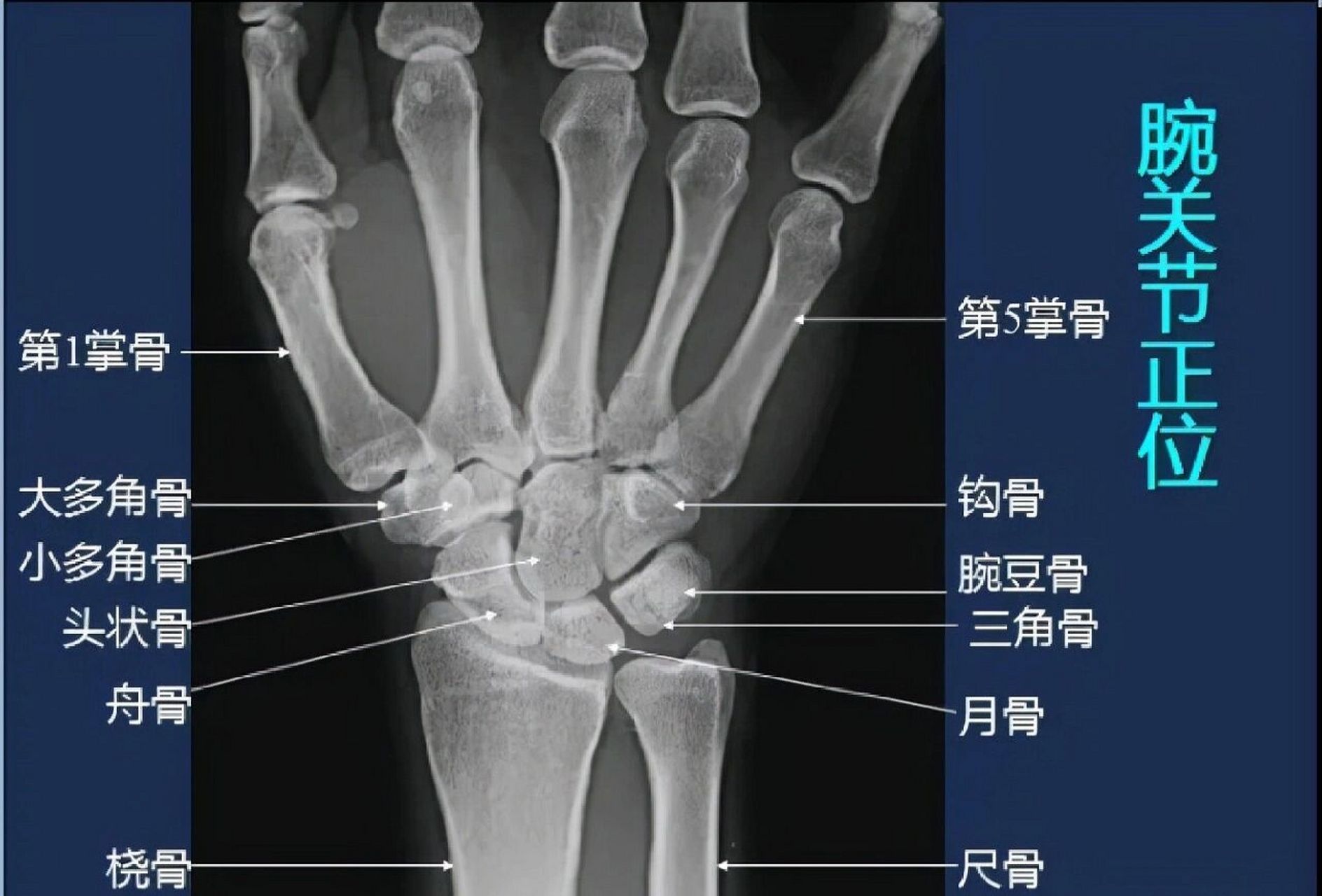 腕关节x线解剖图