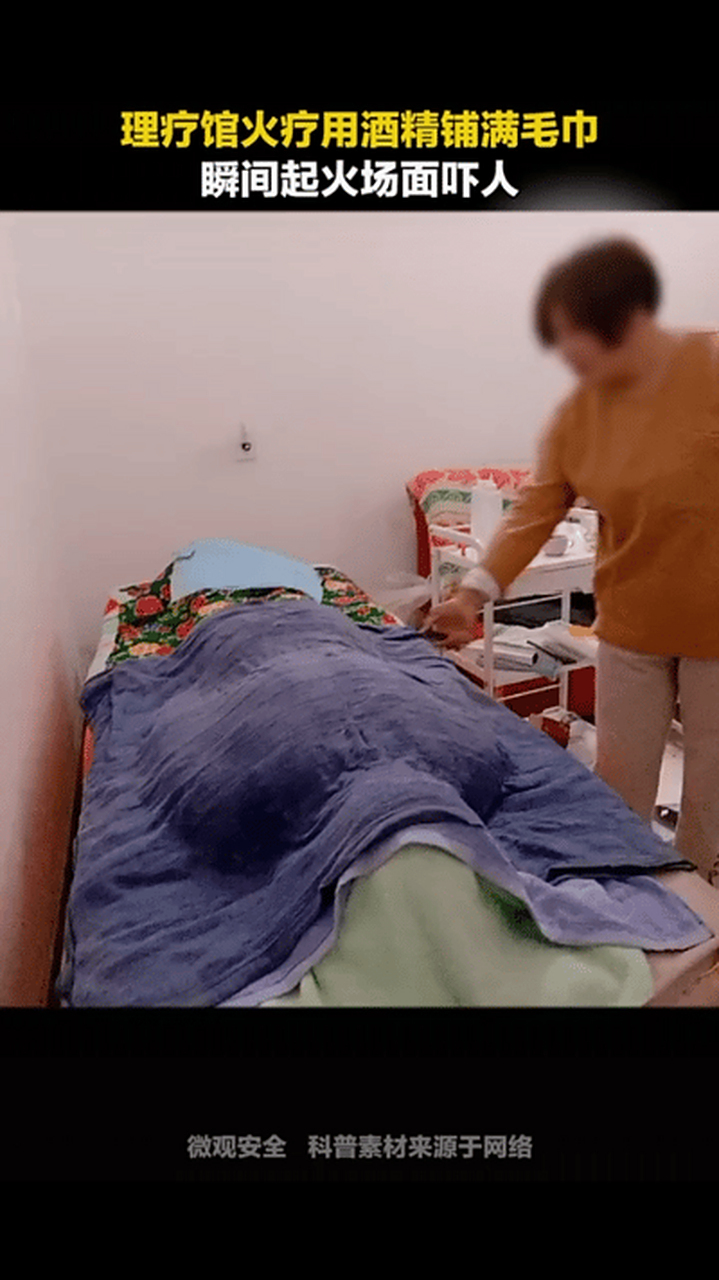 理疗馆的酒精火疗,酒精瞬间着起来的火势很吓人,我是不敢去做啦!