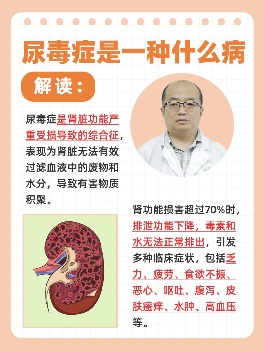 解读:尿毒症是一种什么病 尿毒症全称为尿毒症综合征,是一种由于肾脏