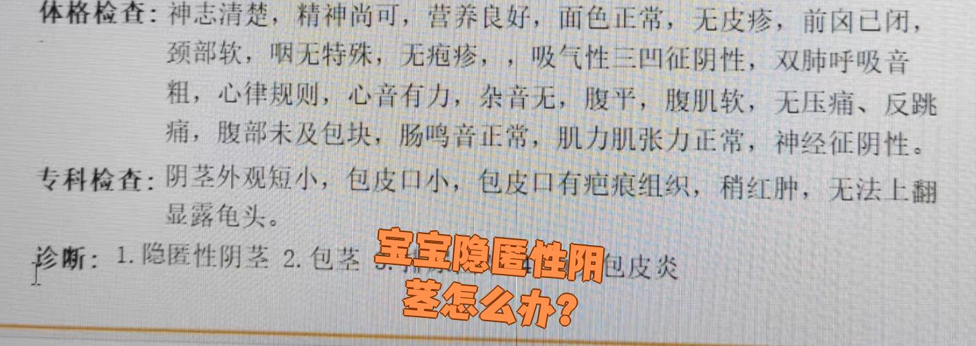 隐匿性阴茎是一种需要手术治疗的先天性阴茎包皮发育畸形