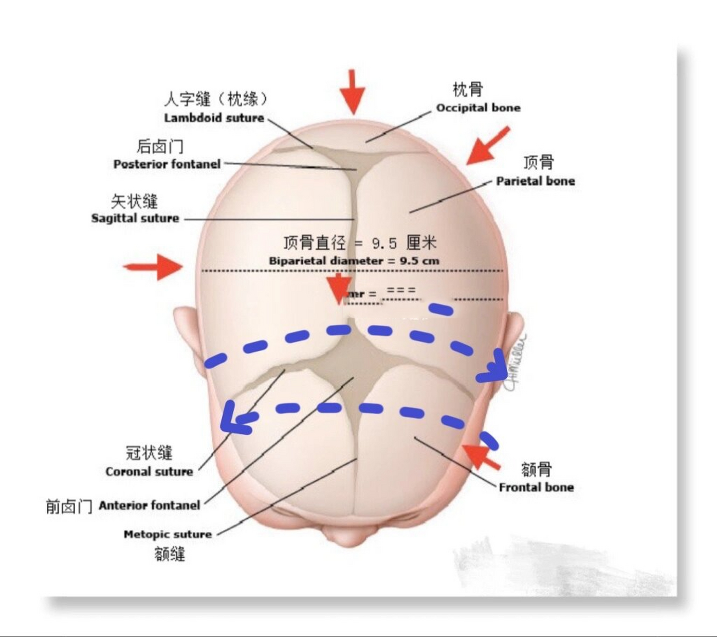 冠状位+矢状位+轴位图图片