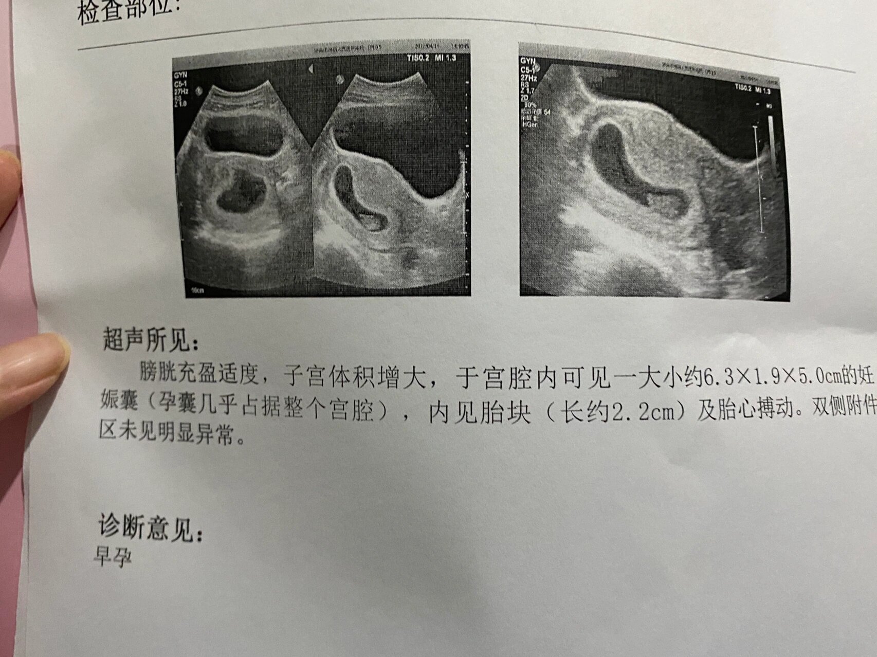 所以姐妹们不要再问