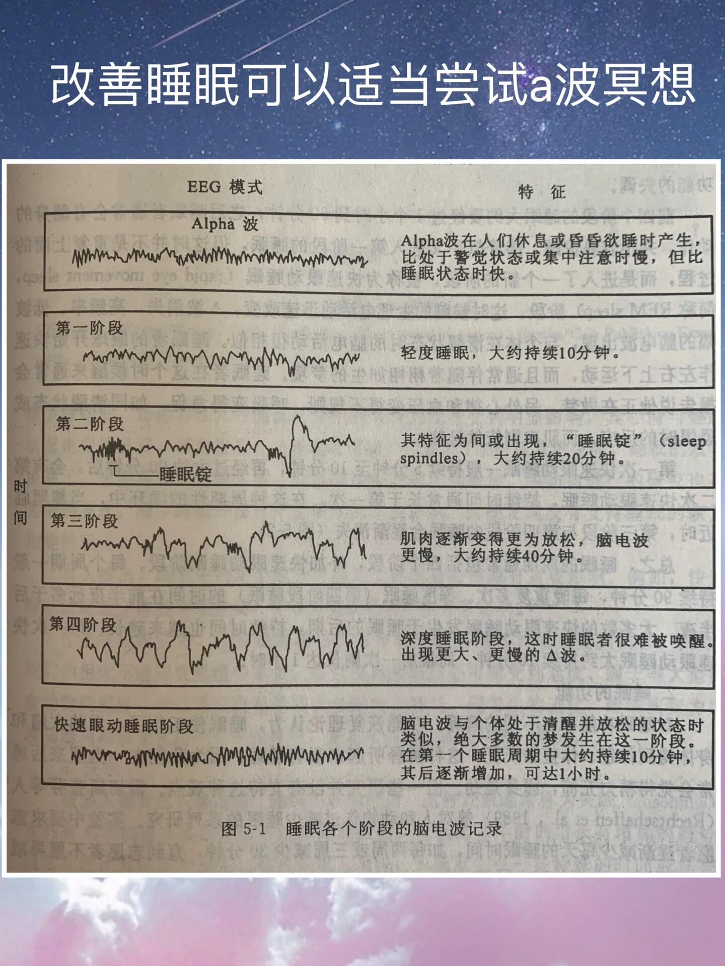 脑电图异常波解读图片