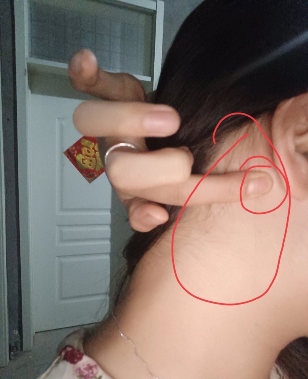 耳后面疼 有没有知道耳后面疼是怎么回事  我的左边耳朵后面   昨天