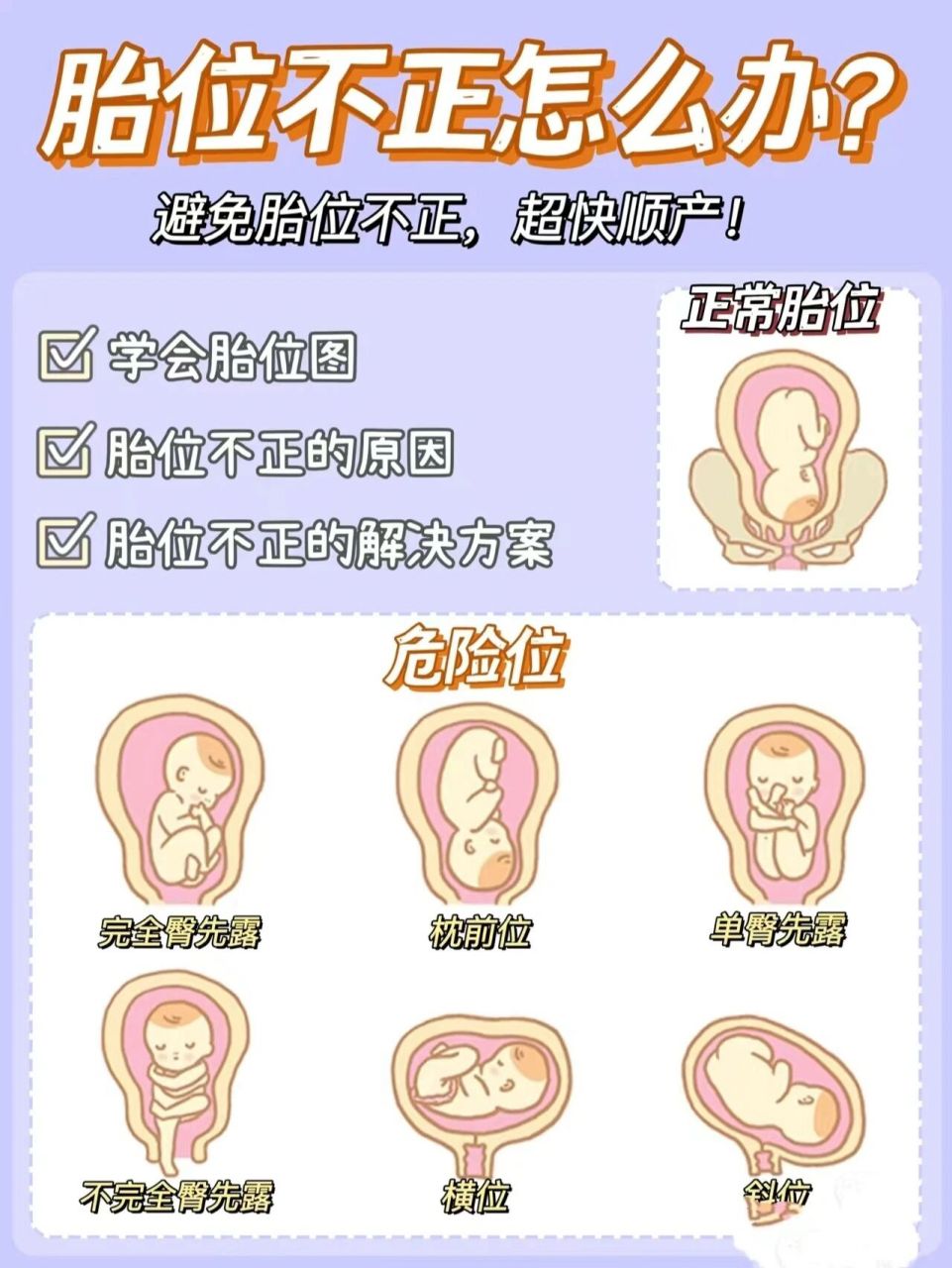 胎位不正怎么 子宫内胎儿的位置称为胎位.