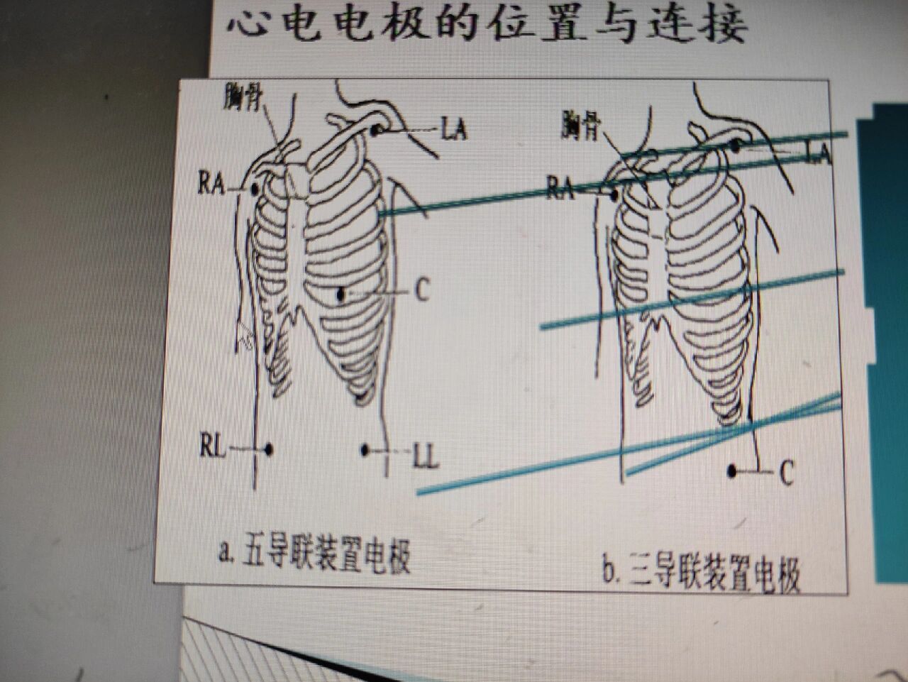 心电监护仪放置位置图图片