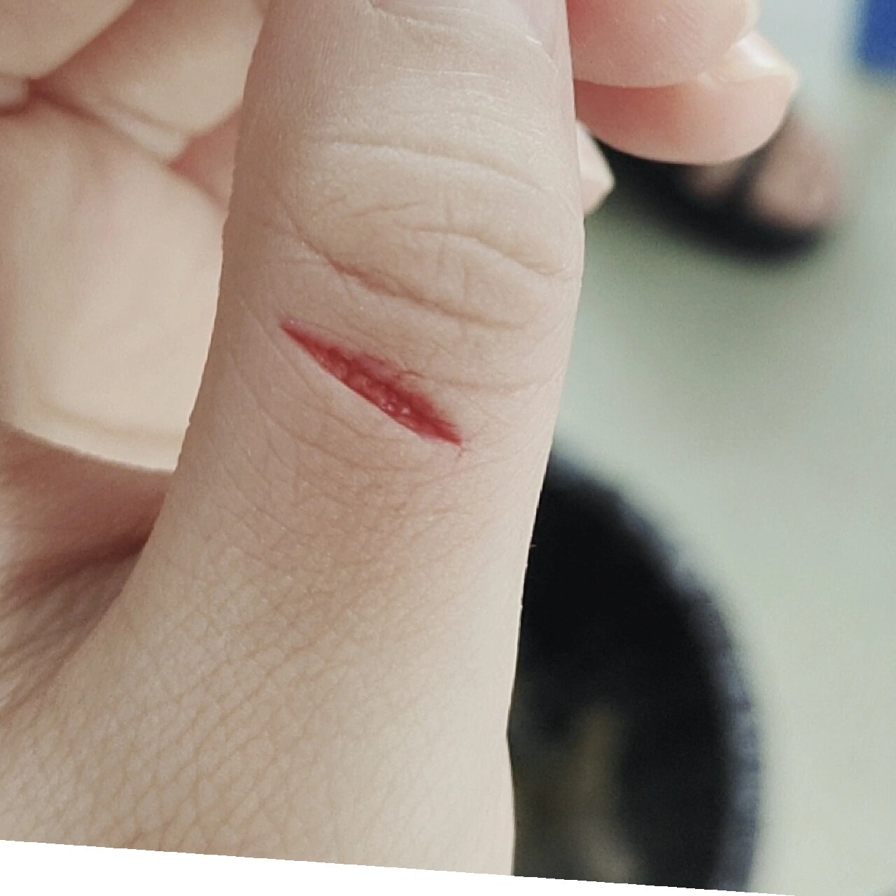 被割伤手真的很痛!