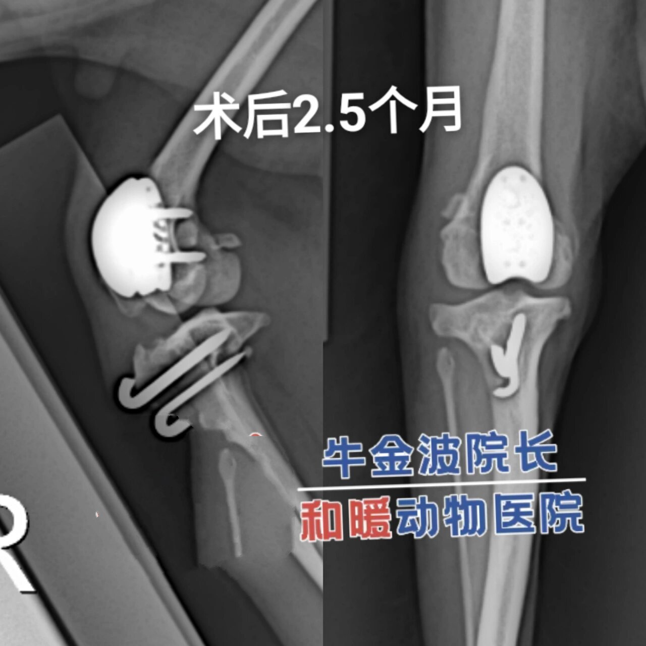 滑车重建术图片