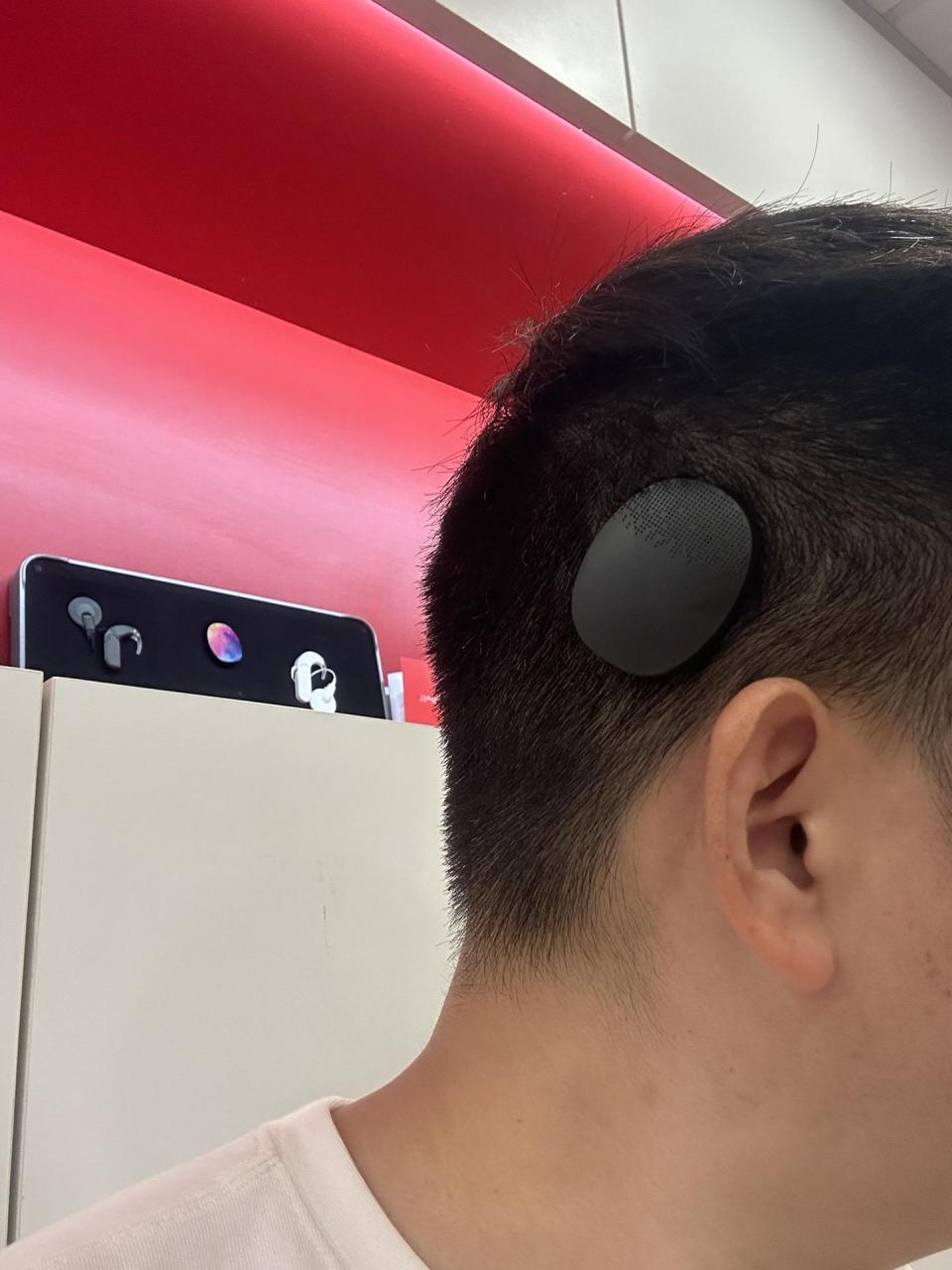 奥地利人工耳蜗rondo3一体机.