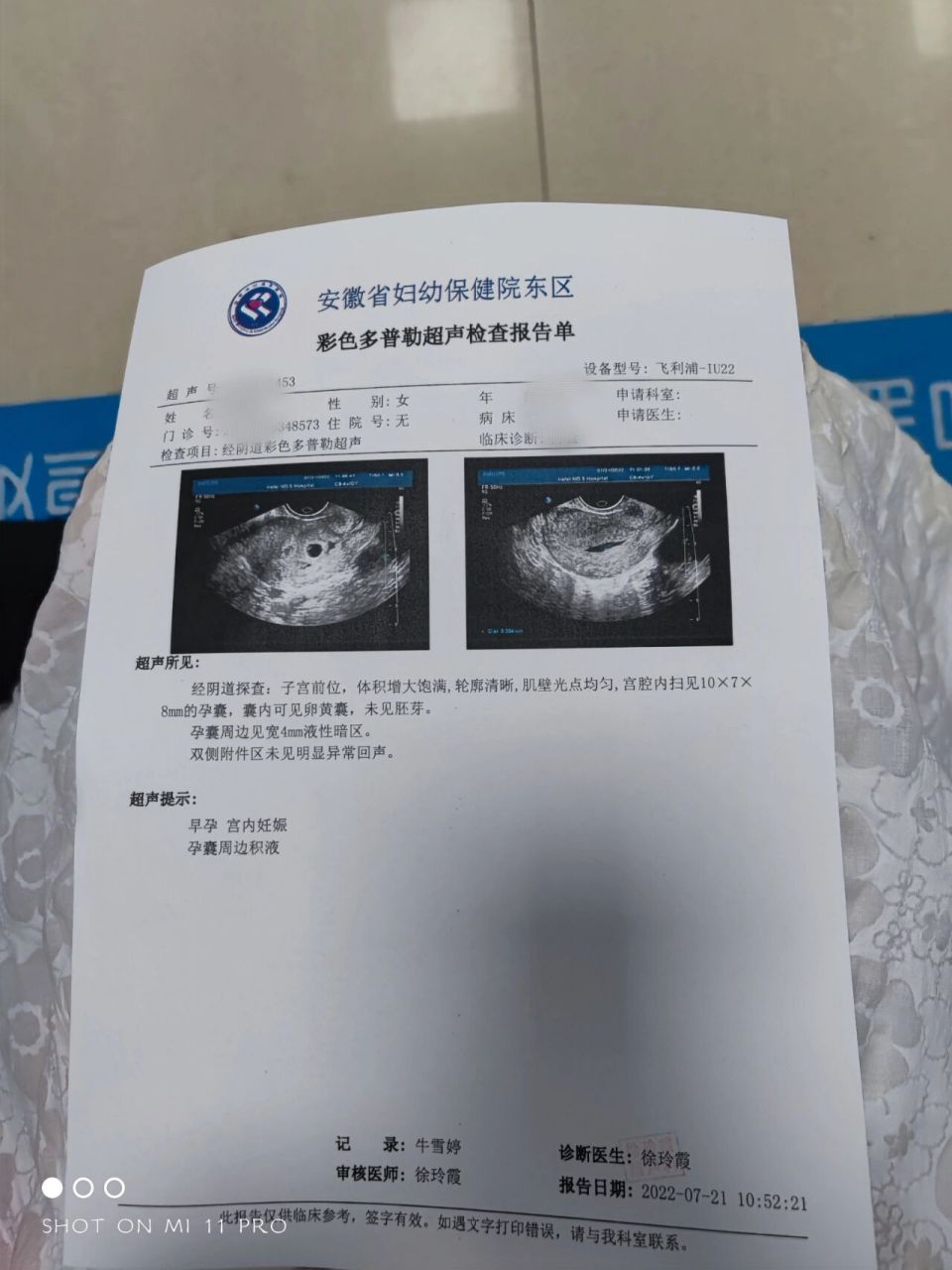 孕第38天 孕囊旁边有4mm积液(血) 去医院检查了,医生说有可能会流产