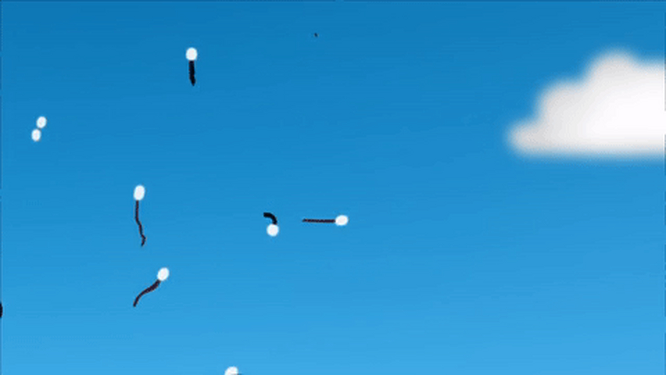 谢瑞尔氏现象# 谢瑞尔氏现象(scheerers phenomenon)  你可能碰倒