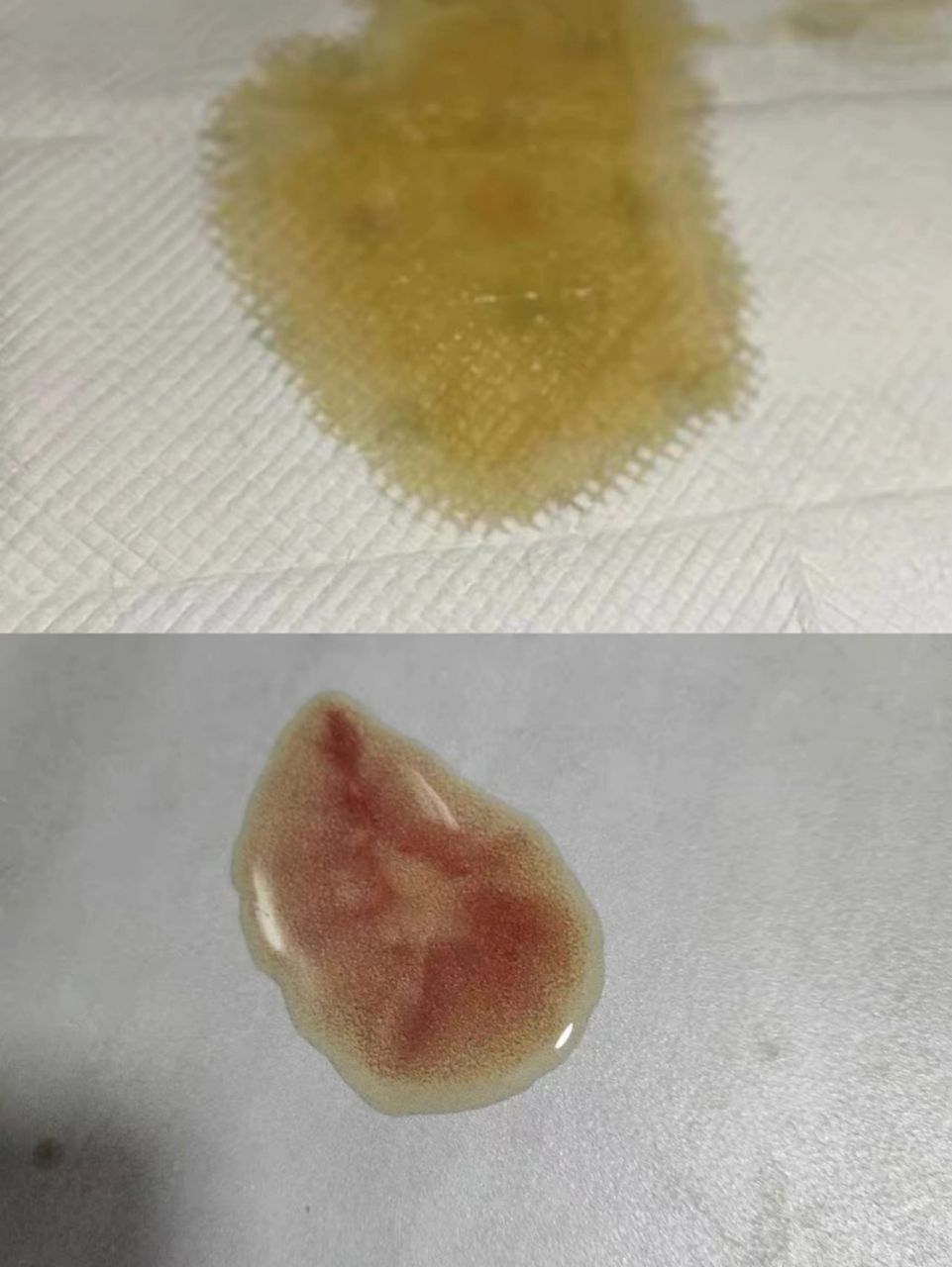 尿路感染还尿血 看完这篇,一定要回去看看你家狗狗尿尿正常不正常!