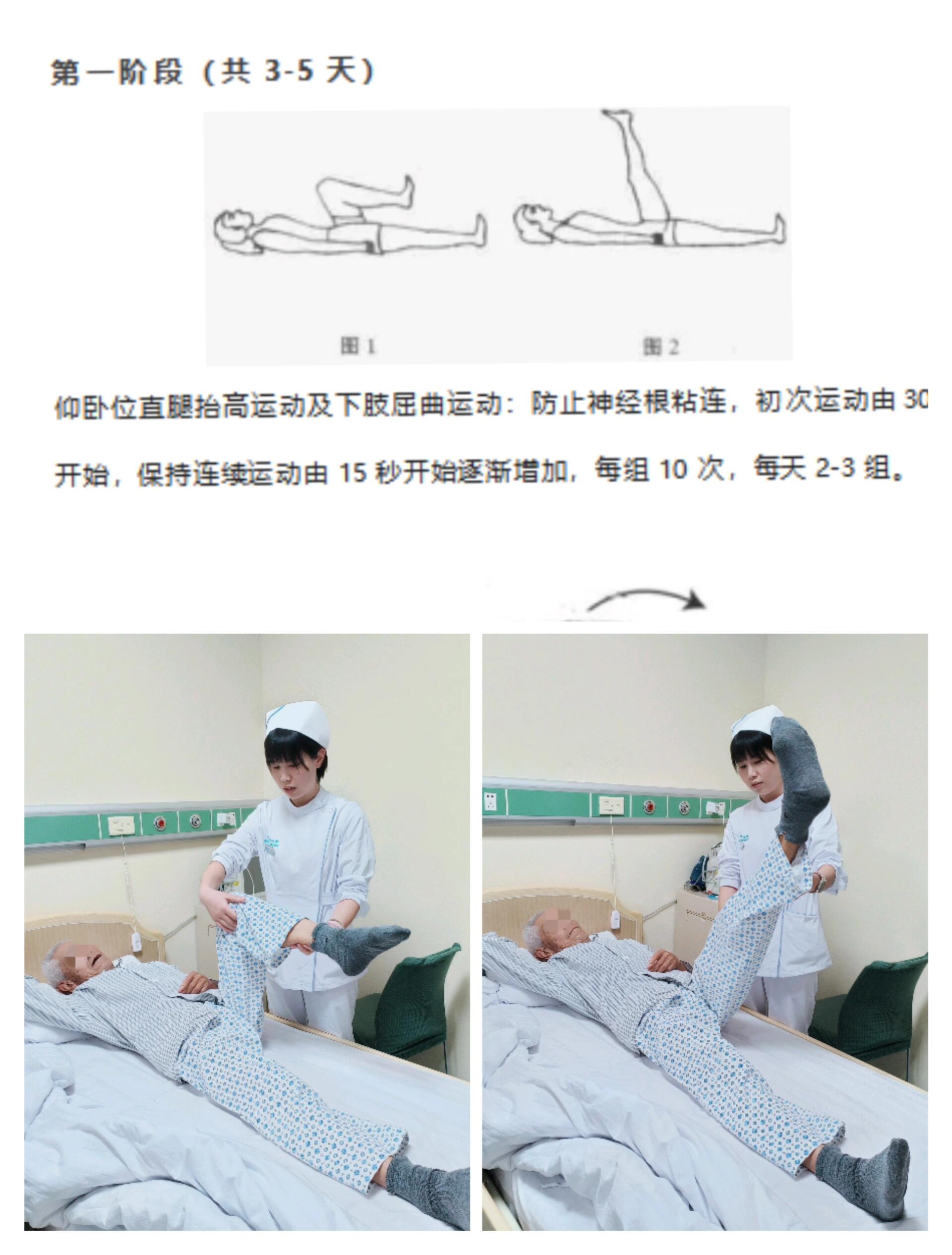 腰椎压缩性骨折后功能锻炼