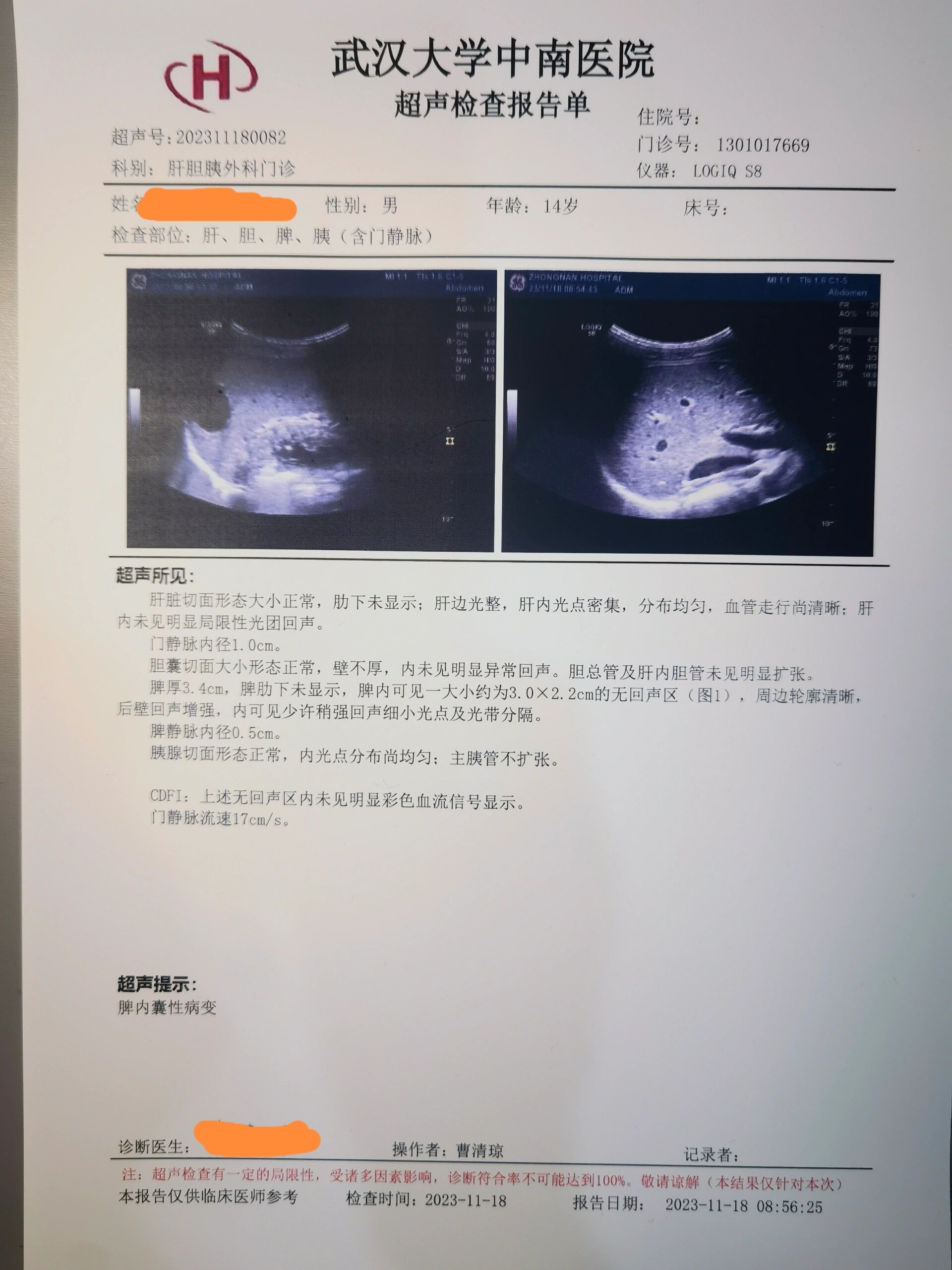 脾囊肿怎么办,做过相关治疗的家人求给个经