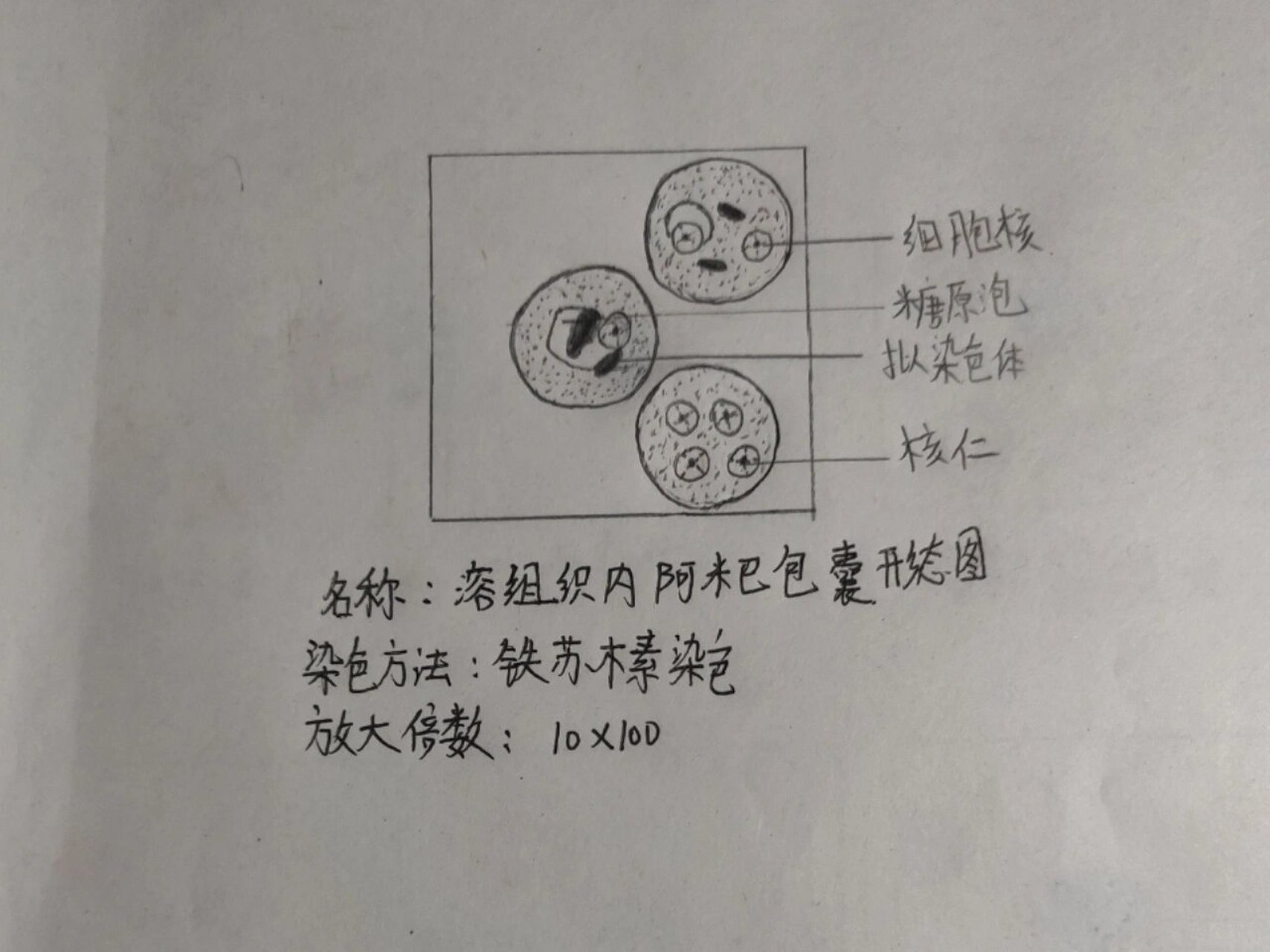 寄生虫实验课绘图-溶组织内阿米巴包囊,刚地弓形虫滋养体,阴道毛滴虫