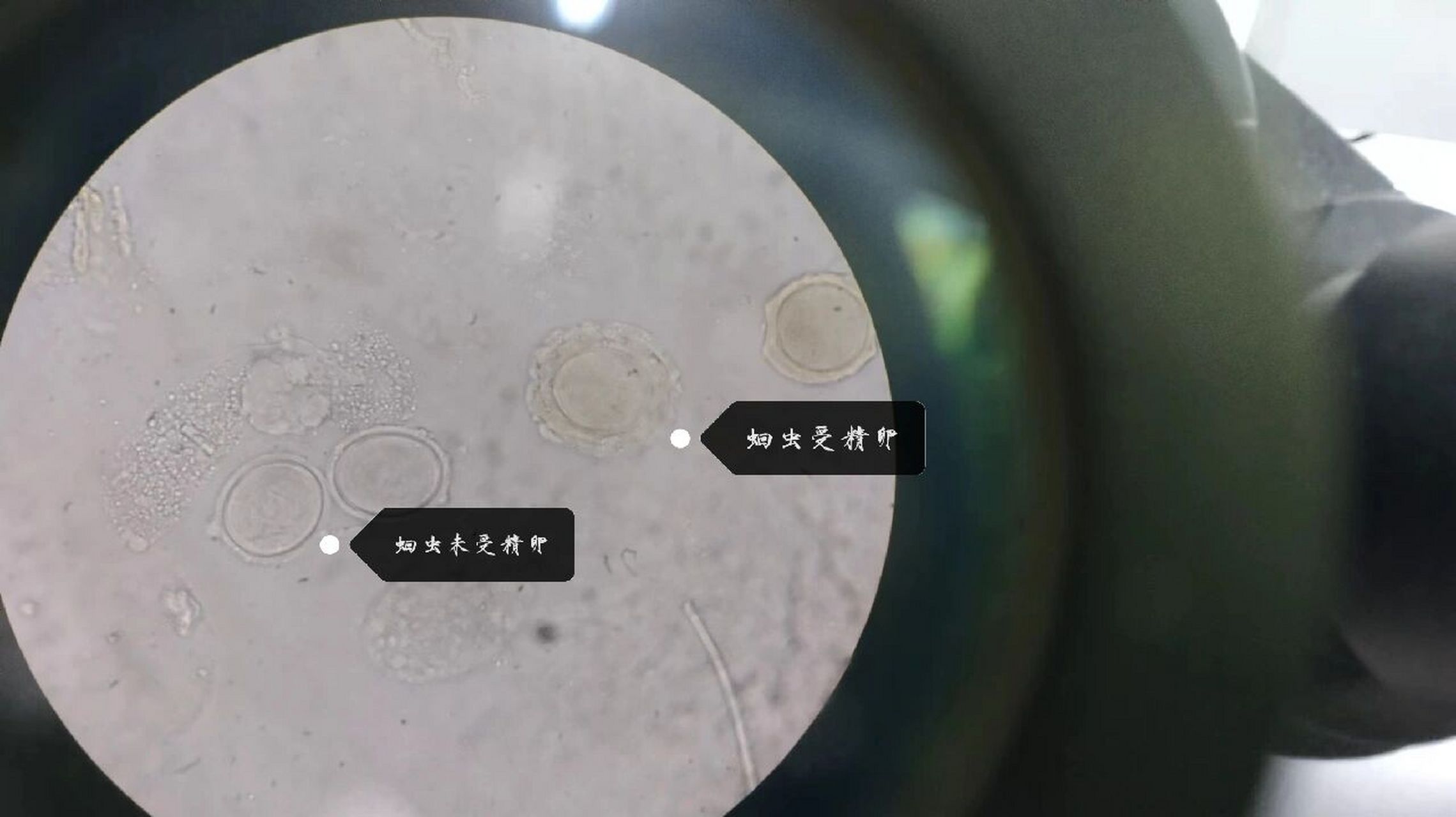 蛔虫卵脱蛋白质膜图图片
