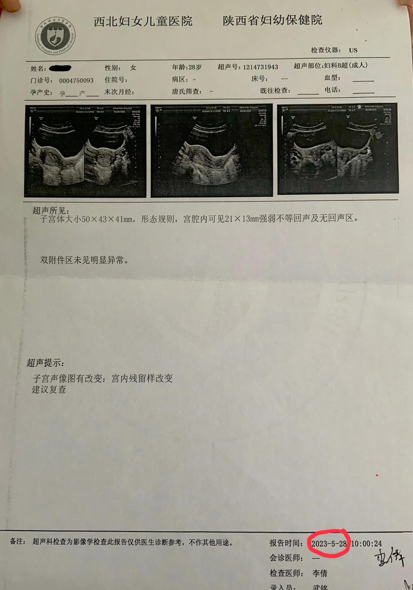 打胎的单子图片图片