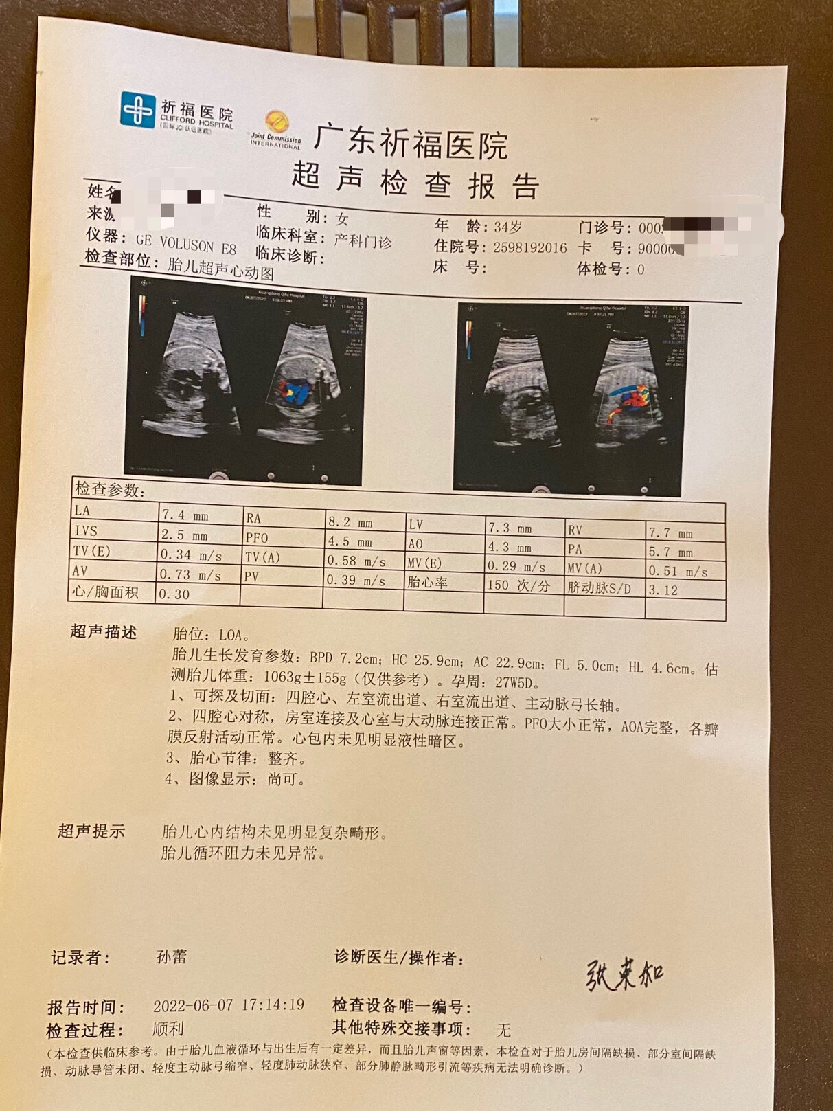 28周做胎儿超声心动图图片