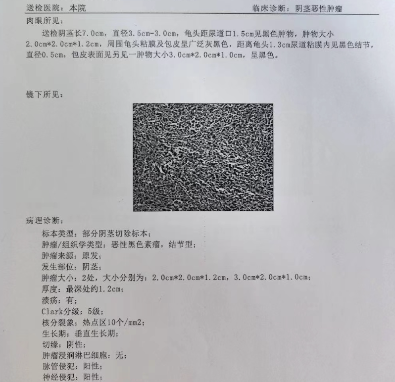 男性青春期发育后,正常情况下龟头就应该露在外面