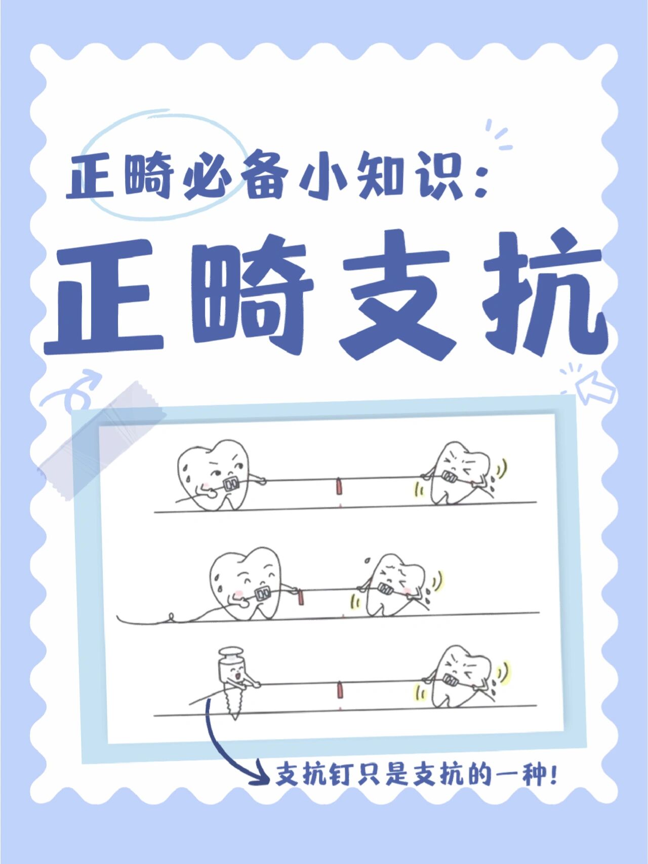 正畸必备小知识:正畸支抗